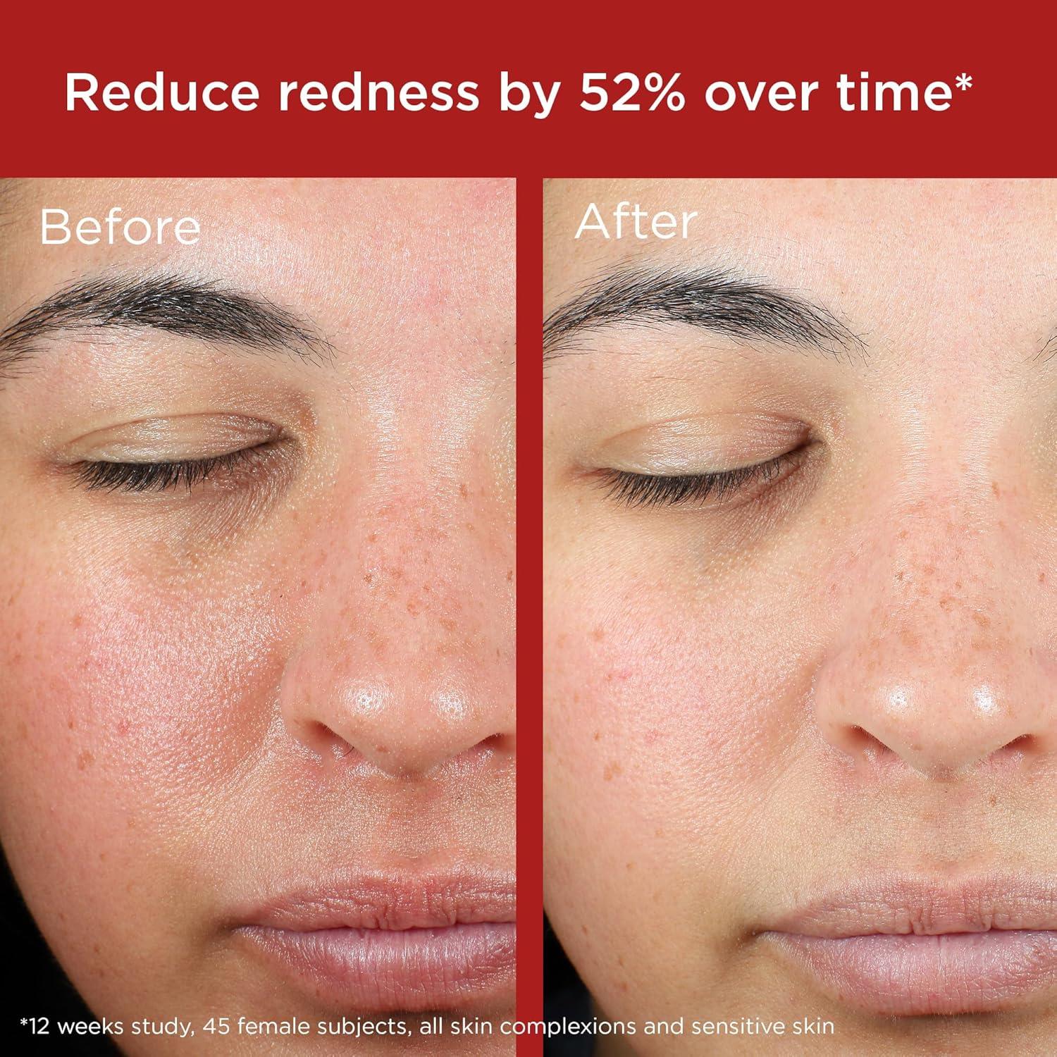 EltaMD Protector Solar Facial SPF 50 Todo Mineral Piel Sensible