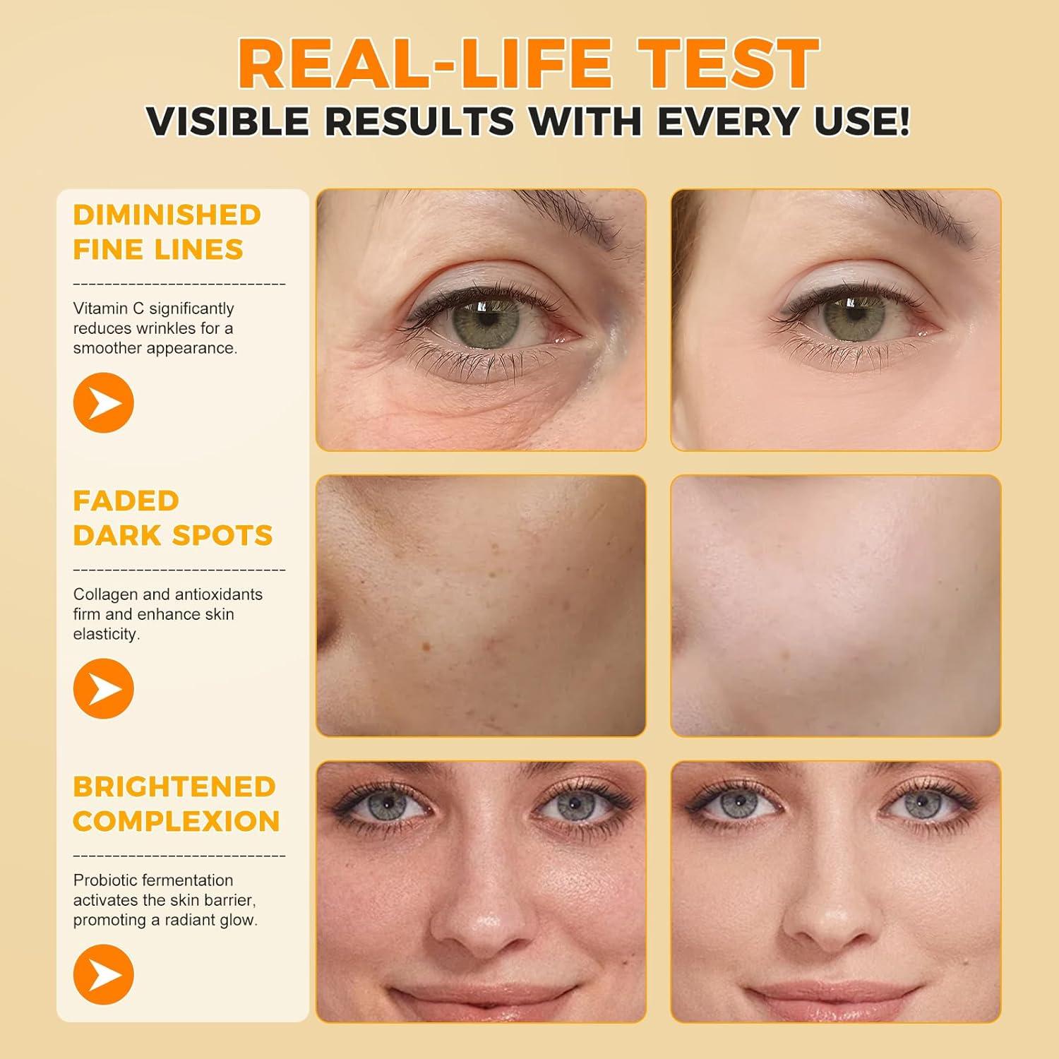 Suero Facial Antienvejecimiento Ruduwu 60ml - Vitamina C y E