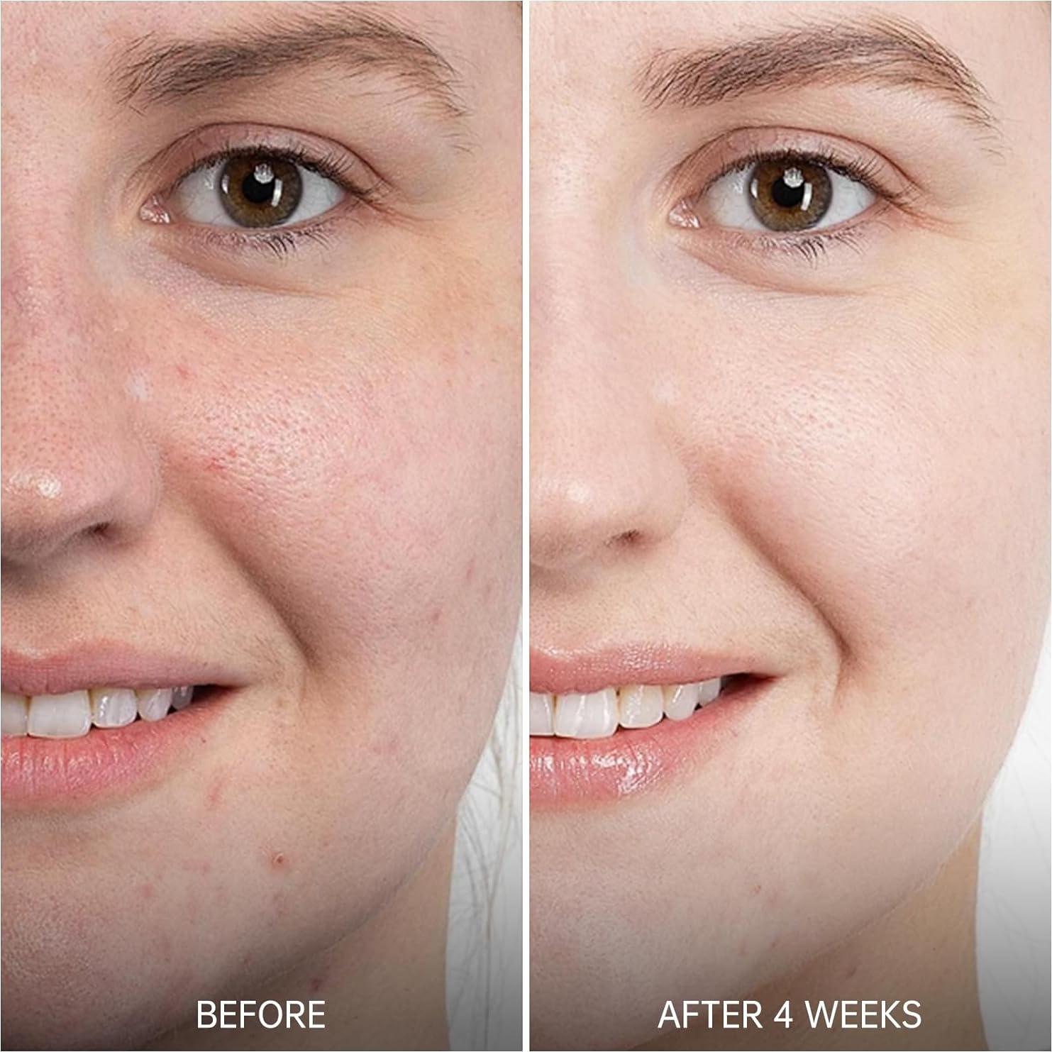 Suero de Retinol VGO 30 ml con Ácido Hialurónico y Niacinamida