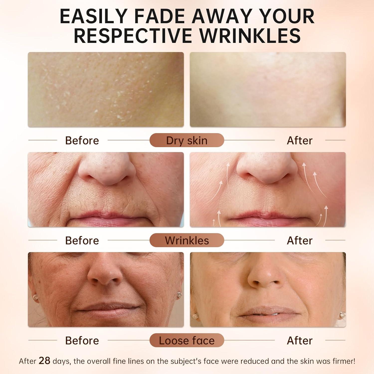 Suero de Retinol VGO 30 ml con Ácido Hialurónico y Niacinamida