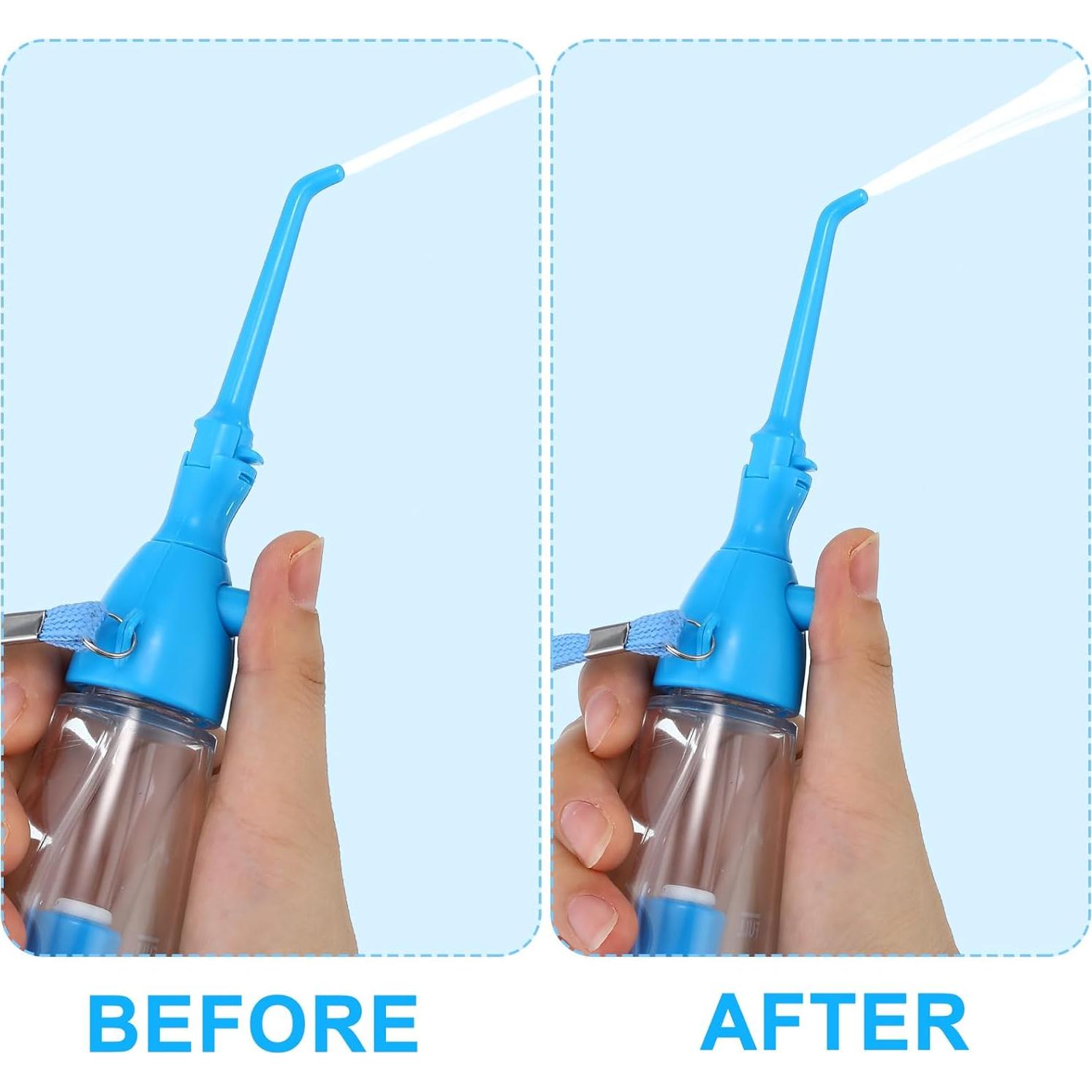 Irrigador Oral Manual Patelai 75ml Portátil Azul