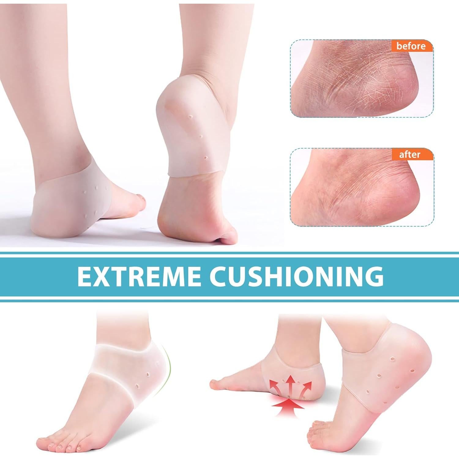 Protectores de Talón de Gel RooRuns para Dolor y Fascitis Plantar