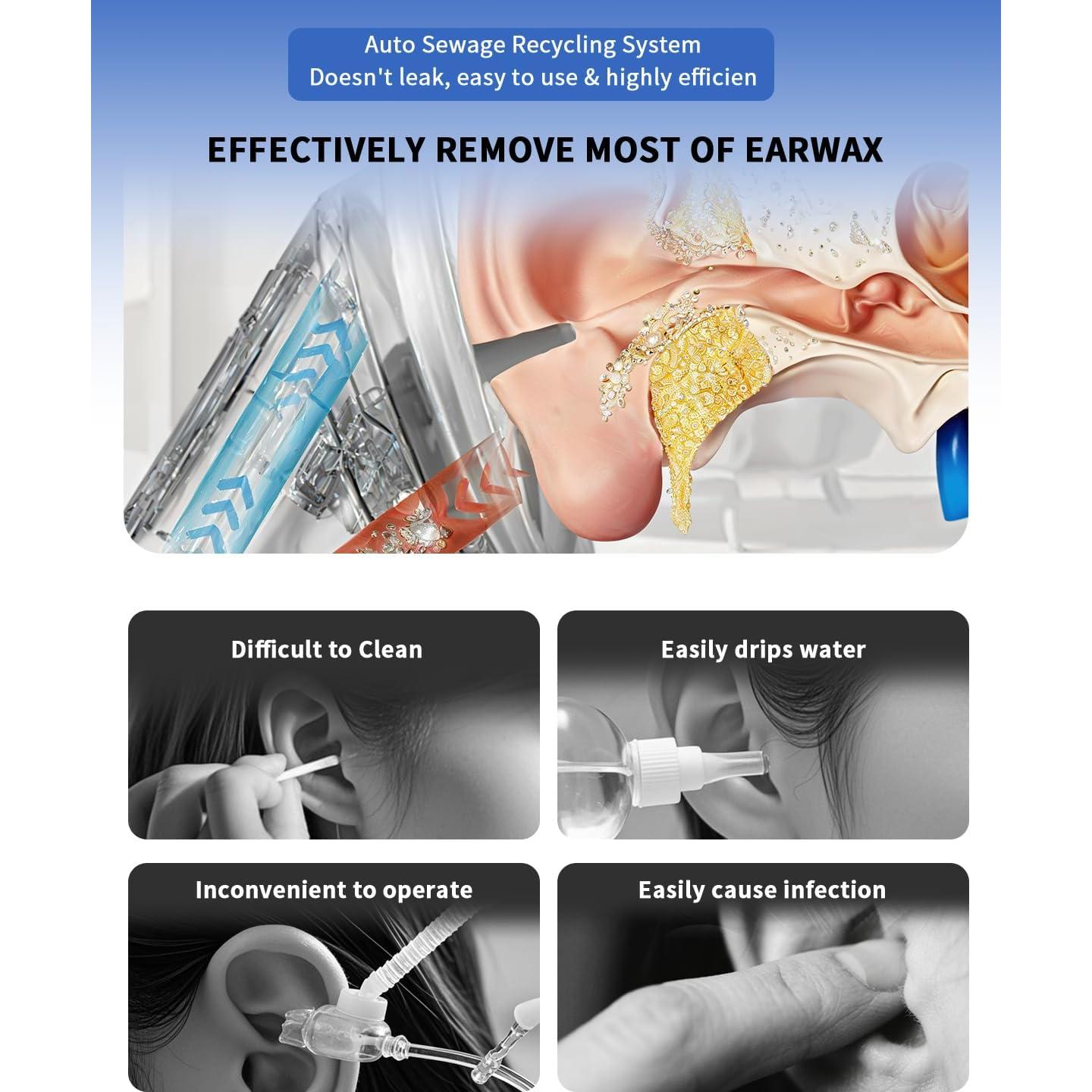 Limpiador de Oídos Eléctrico Acutedge con Tanque Integrado - 4 Modos