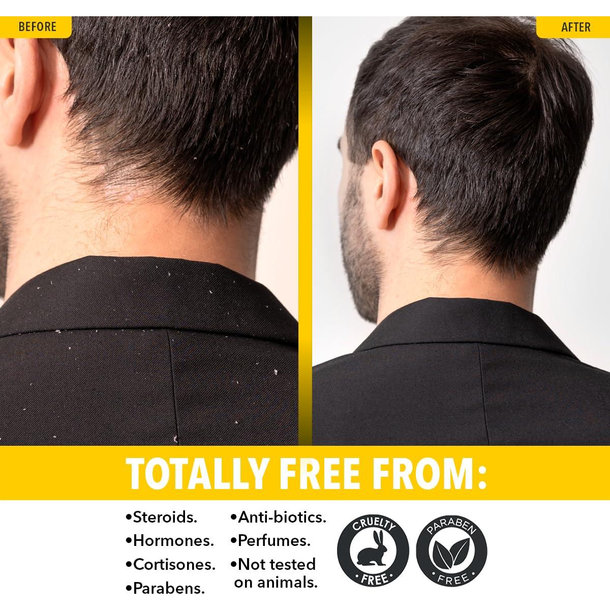 Champú y Gel de Baño Dr. Robaina Sulfur 236 ml - Anticaspa