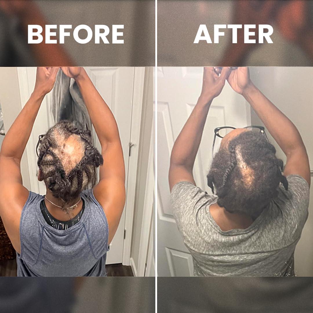 Suero de Crecimiento Capilar Rennora 30 ml - Sin Químicos