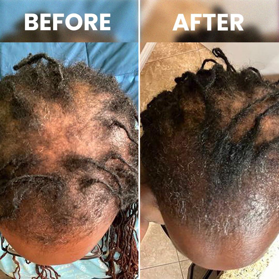 Suero de Crecimiento Capilar Rennora 30 ml - Sin Químicos