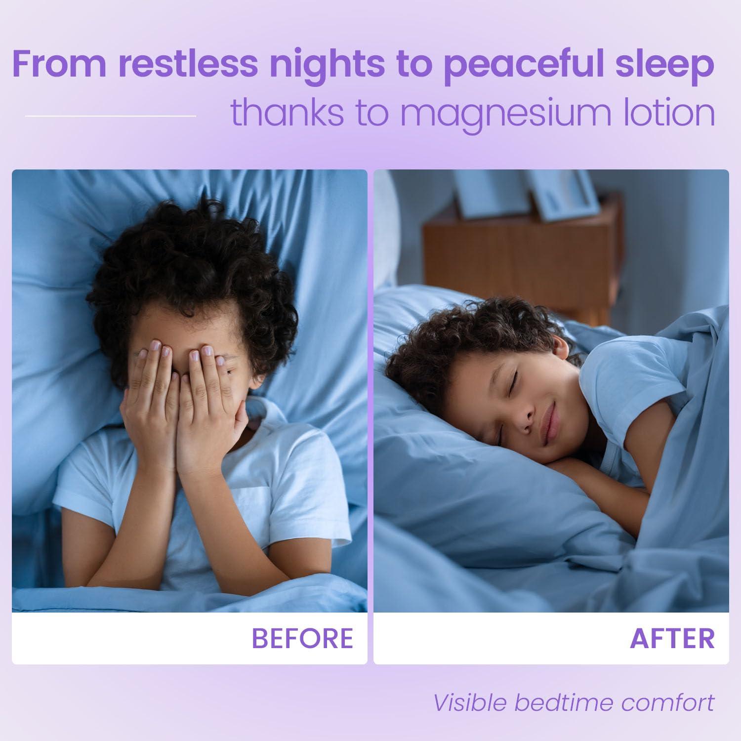 Loción de Magnesio Easment 118 ml para Sueño y Calma Niños