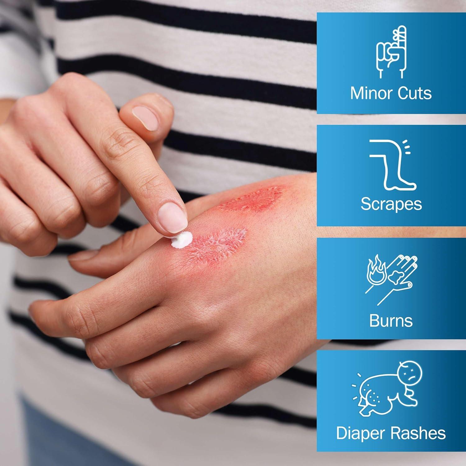 Ungüento de Óxido de Zinc TenderGentle 28 g - Protector Piel Erupciones