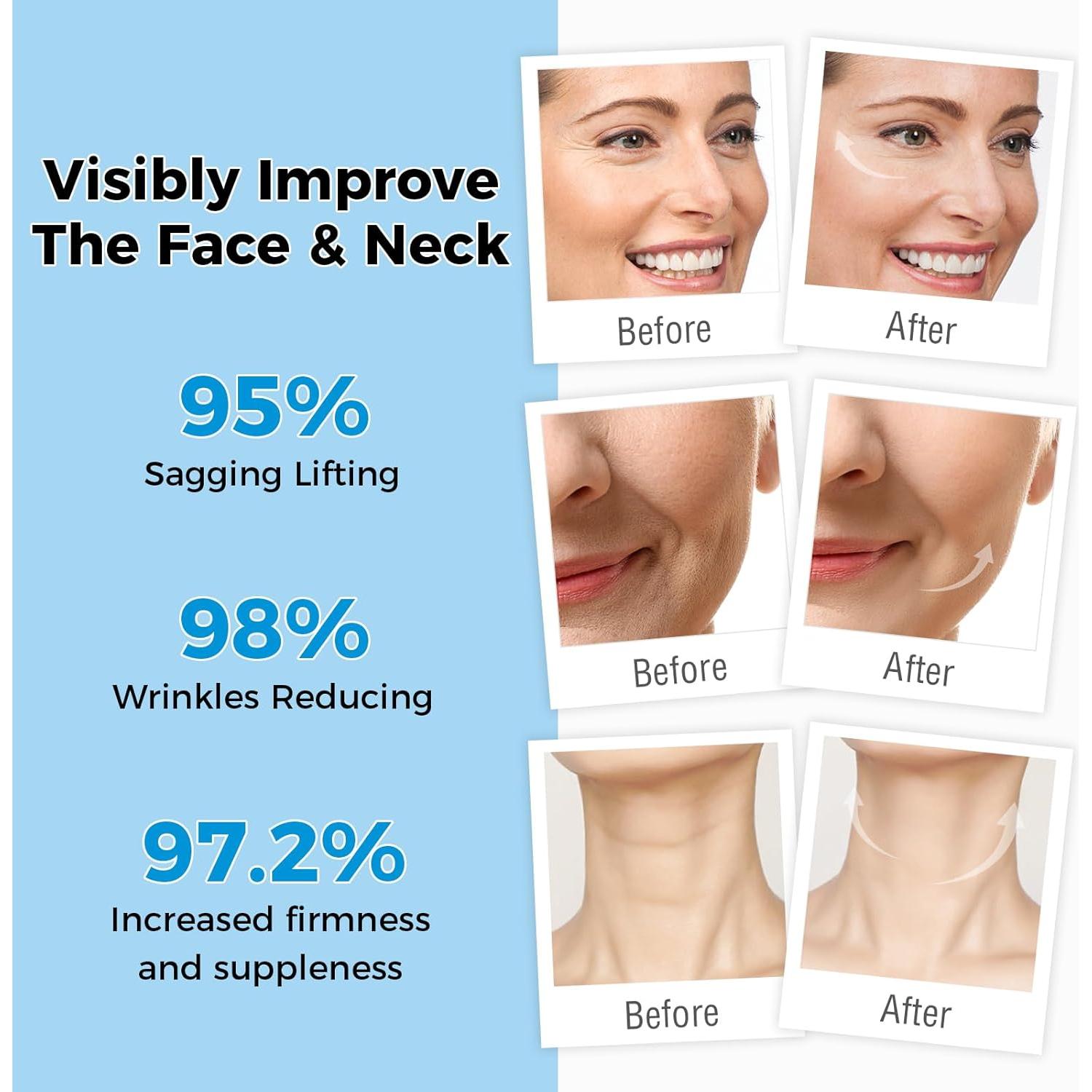 Crema Hidratante Anti-Envejecimiento OUKEYA 3% Retinol 50g