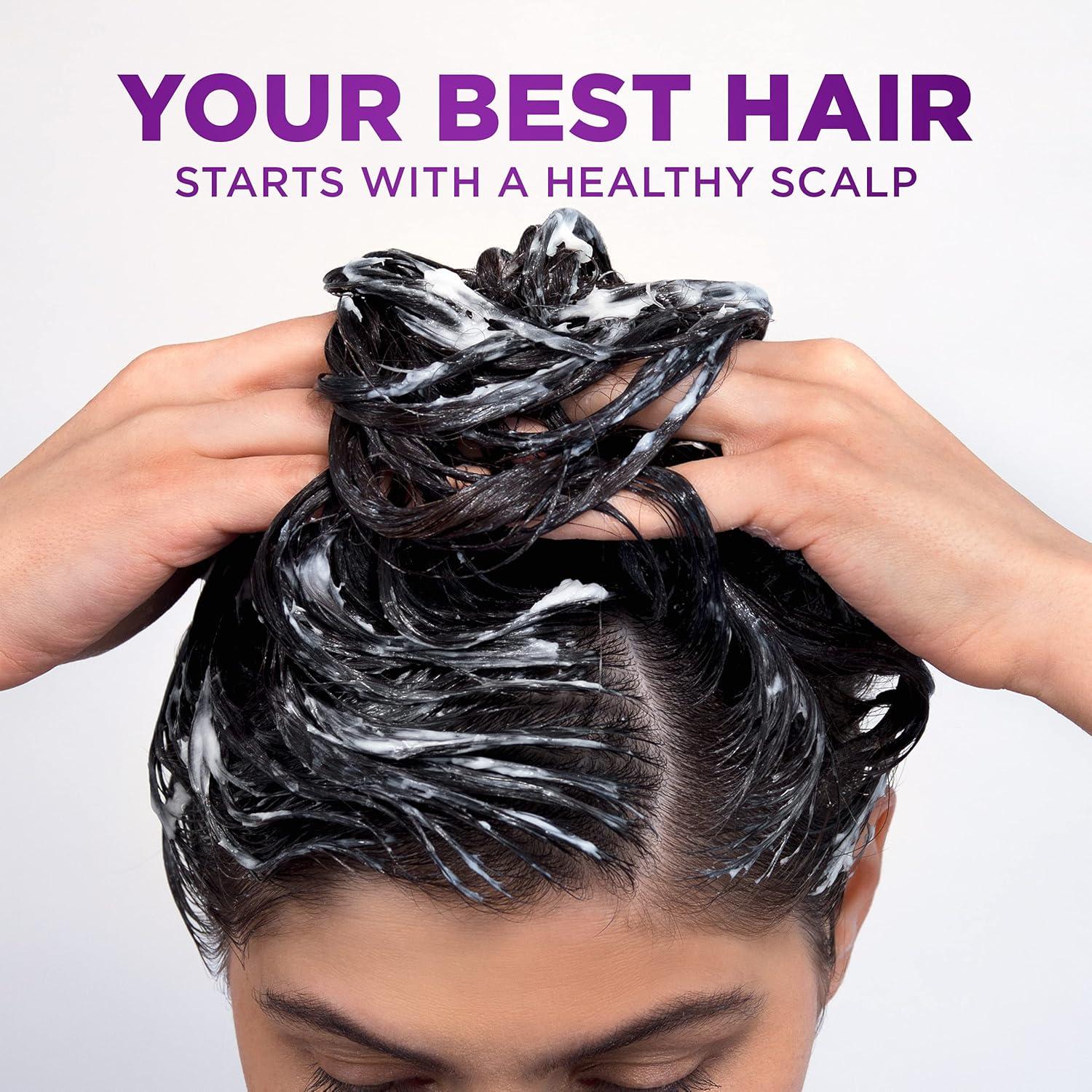 Acondicionador Anticaspa Scalp X Head & Shoulders 148 ml Mujeres