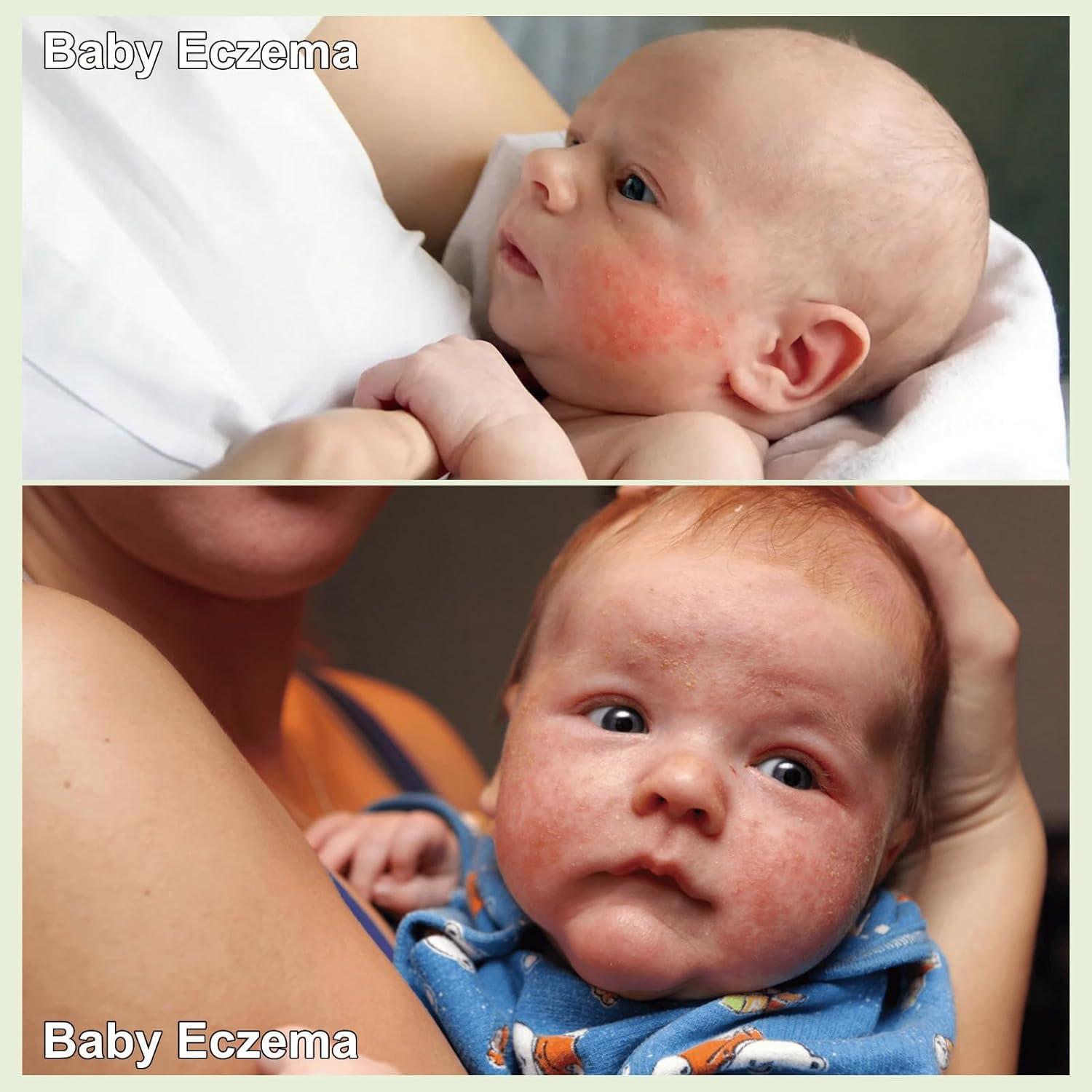 Crema para Bebés Cuidado Erupciones Calor 100ml - Senmai