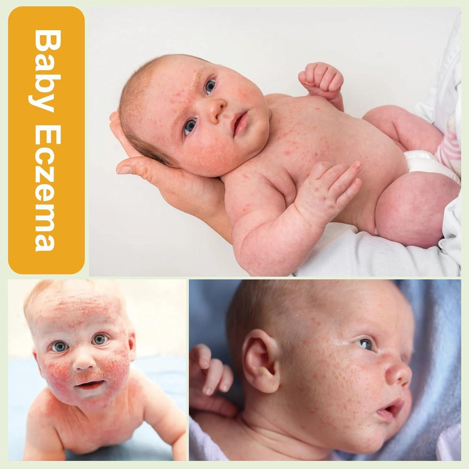 Crema para Bebés Cuidado Erupciones Calor 100ml - Senmai