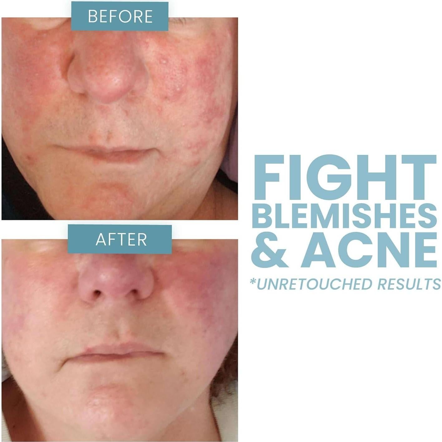 Suero Facial de Vitamina C 20% Eva Naturals - 29.57 ml