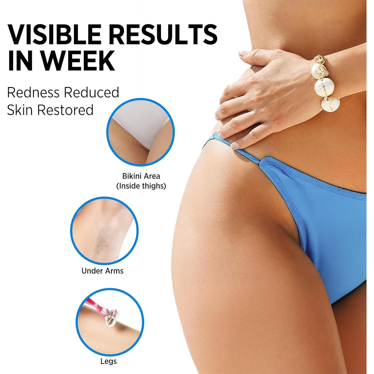 Aceite Tratamiento Vello Encarnado Metyou 80ml - Piel Suave