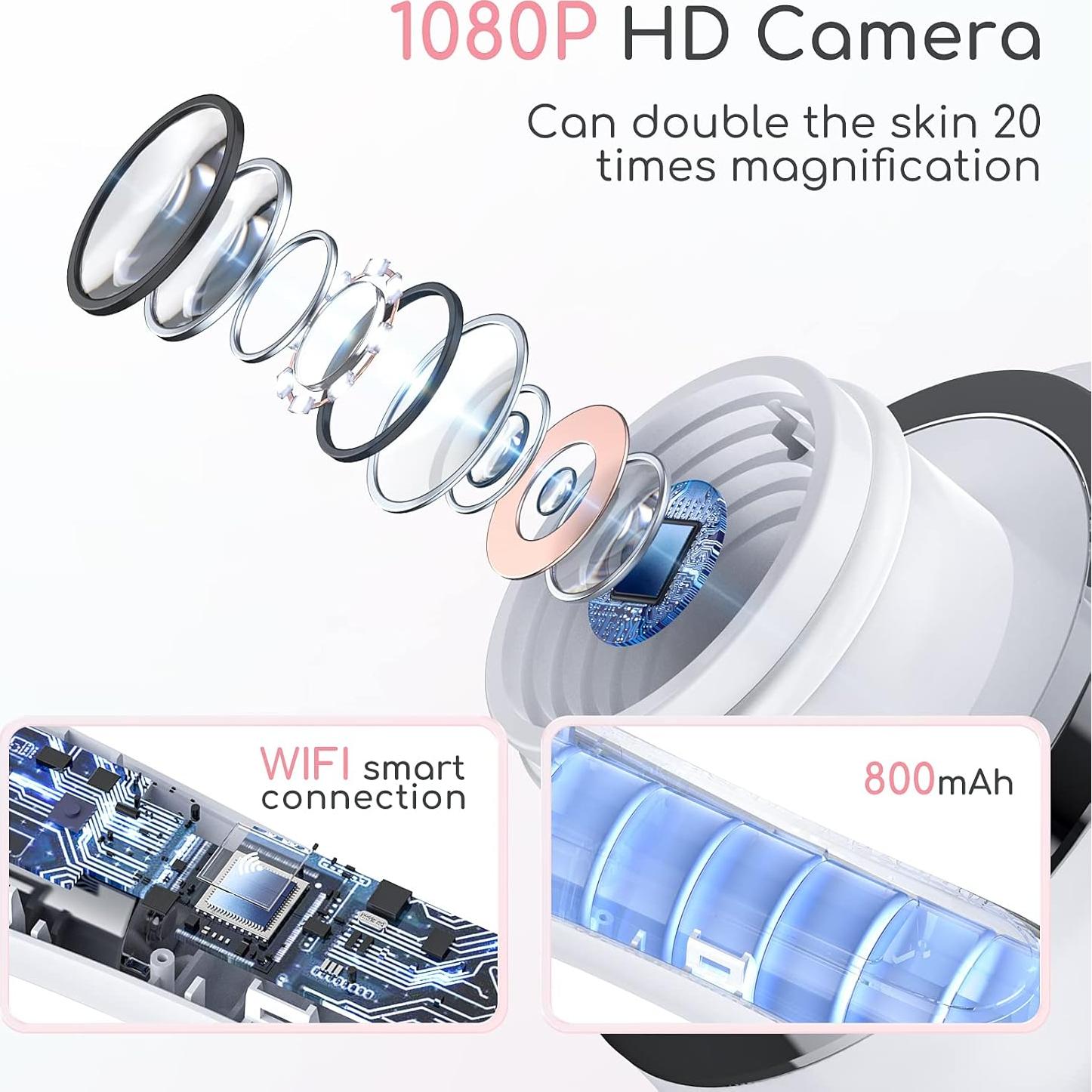 Removedor de Puntos Negros TTozka H200 con Cámara HD y 6 Cabezas