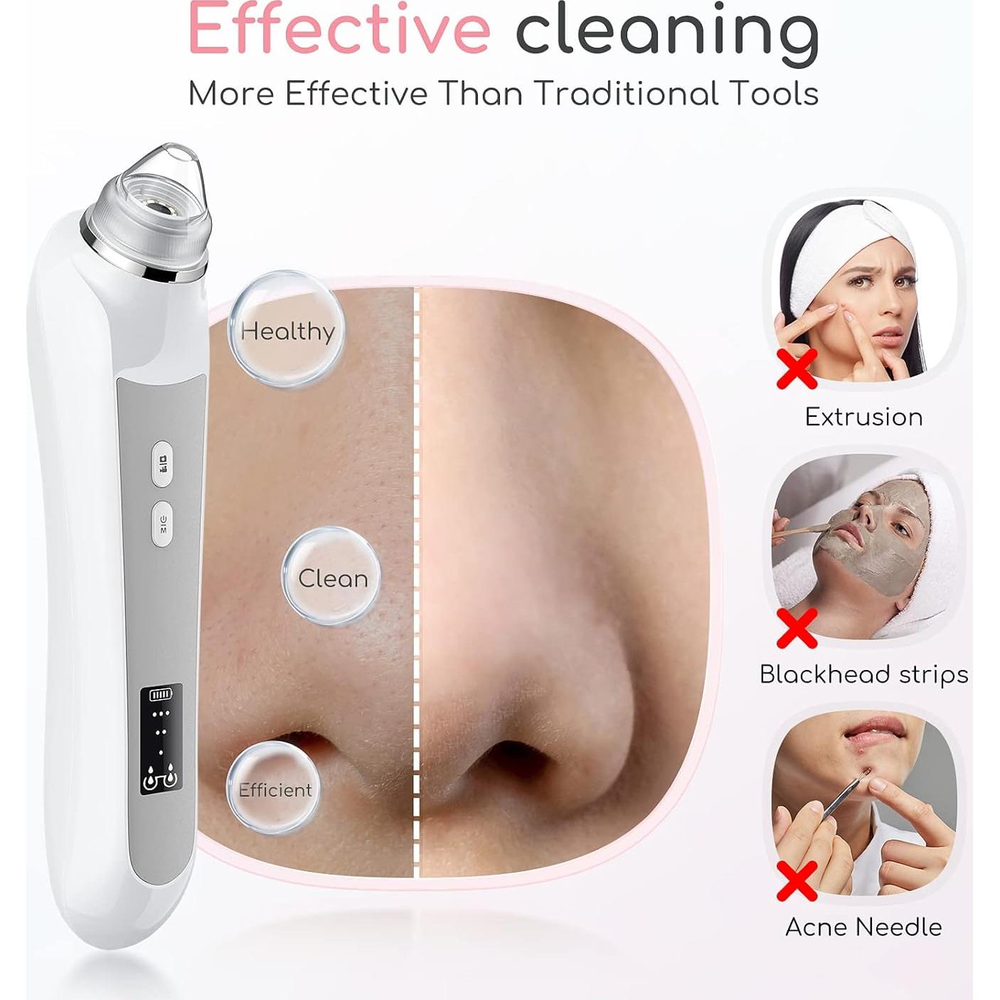 Removedor de Puntos Negros TTozka H200 con Cámara HD y 6 Cabezas