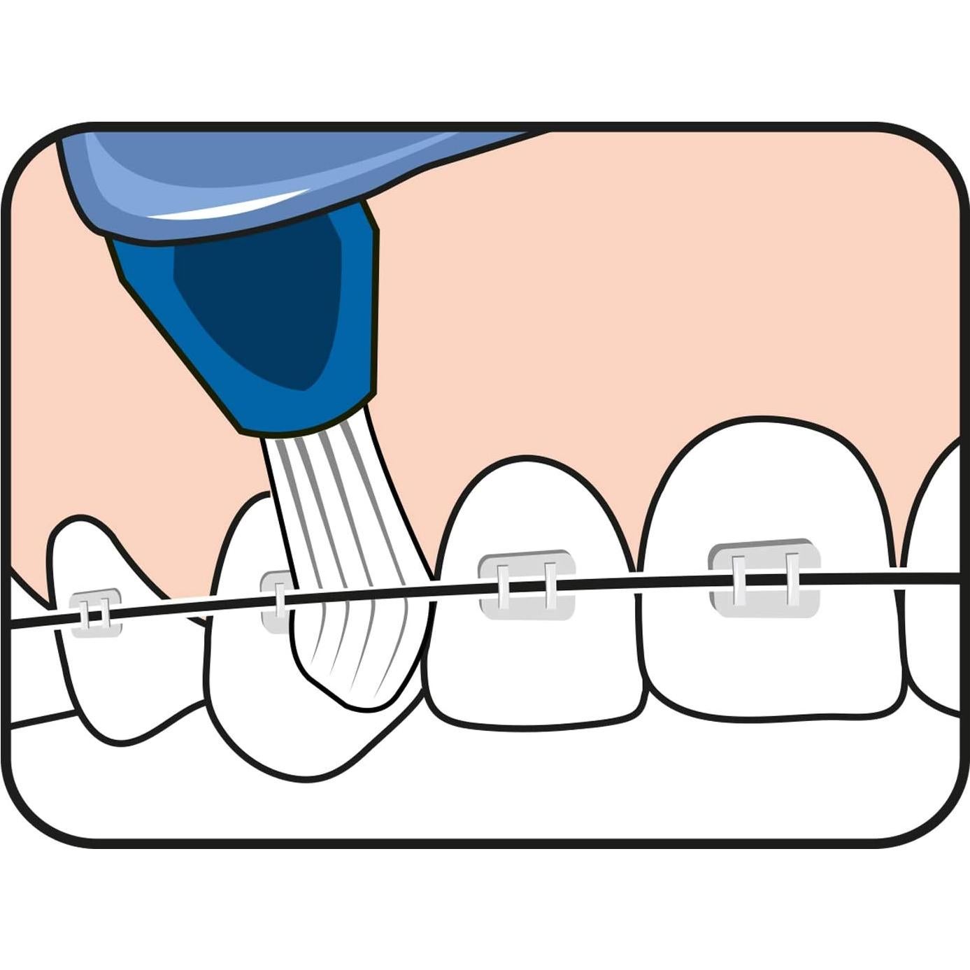 Cepillo de Dientes TePe Interspace Angled Medio para Brackets - Paquete de 12