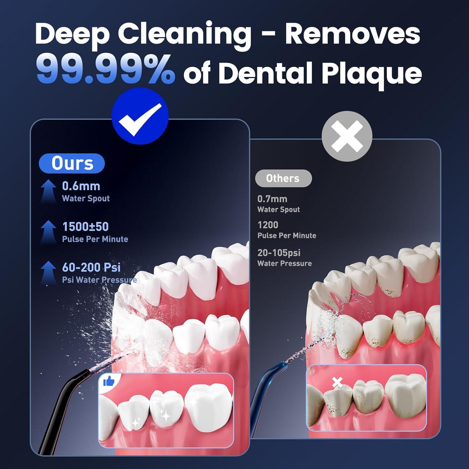 Irrigador Oral Inalámbrico Recargable JJC205 320ml Negro