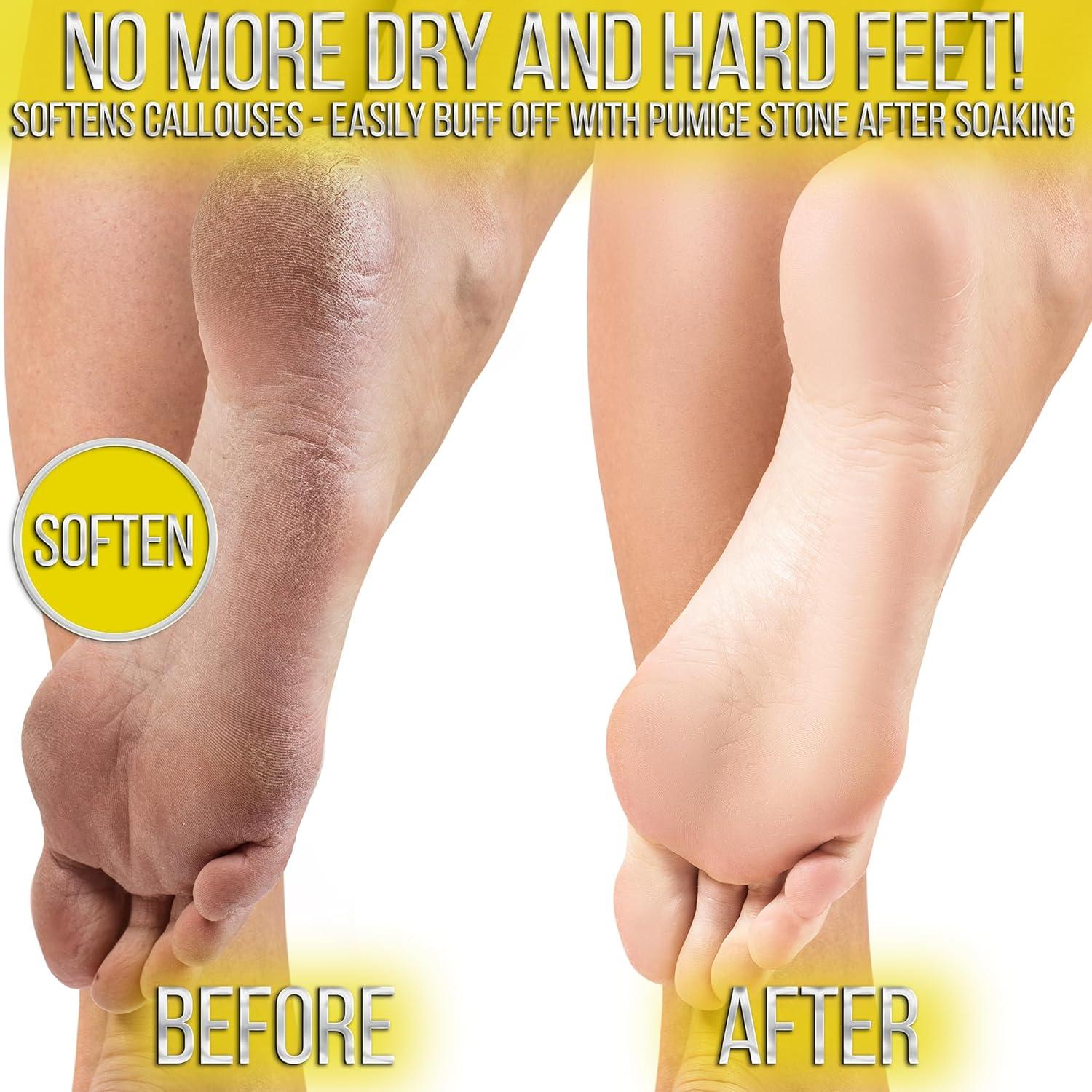 Paquete de Pedicura SOO Jelly - Remojo de Gel Hidratante Jazmín Árabes