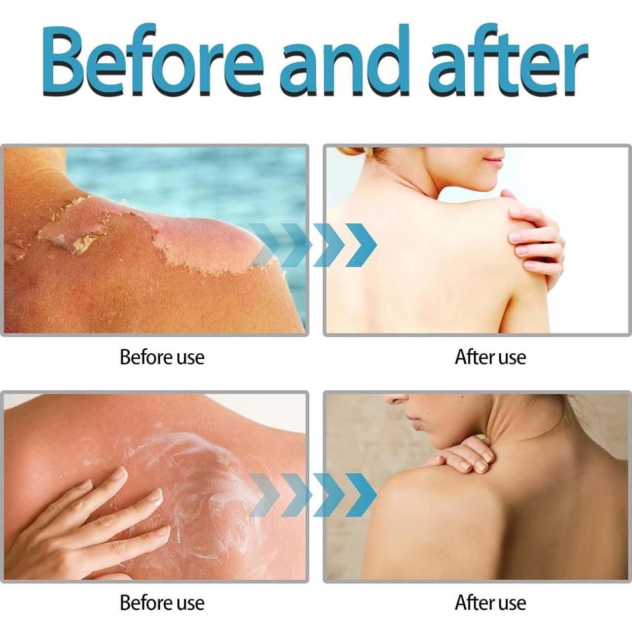 Protector Solar Centella SPF50 XBGEZK 2 Pcs Suero Hidratante