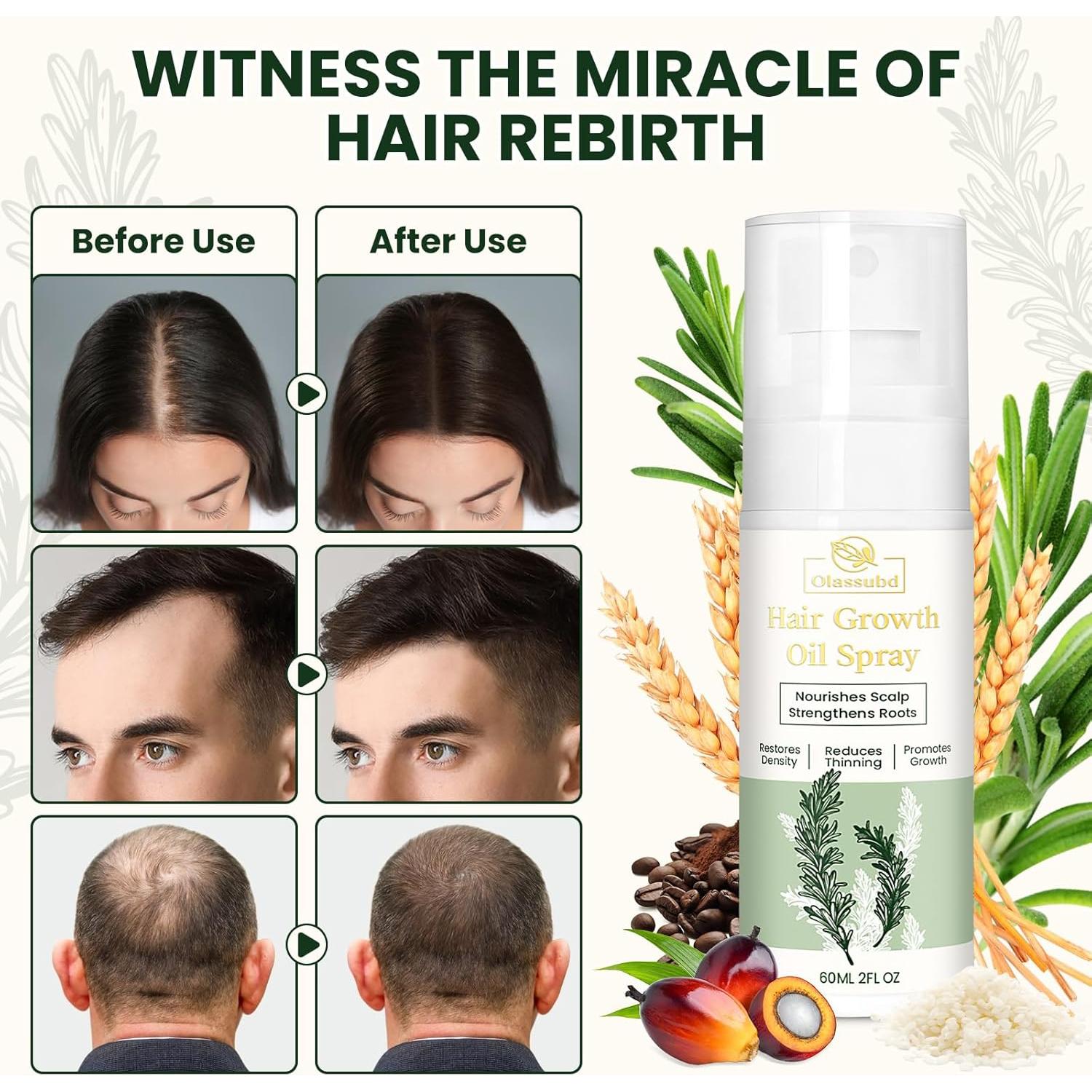 Spray de Aceite para Crecimiento del Cabello Olassubd 118 ml