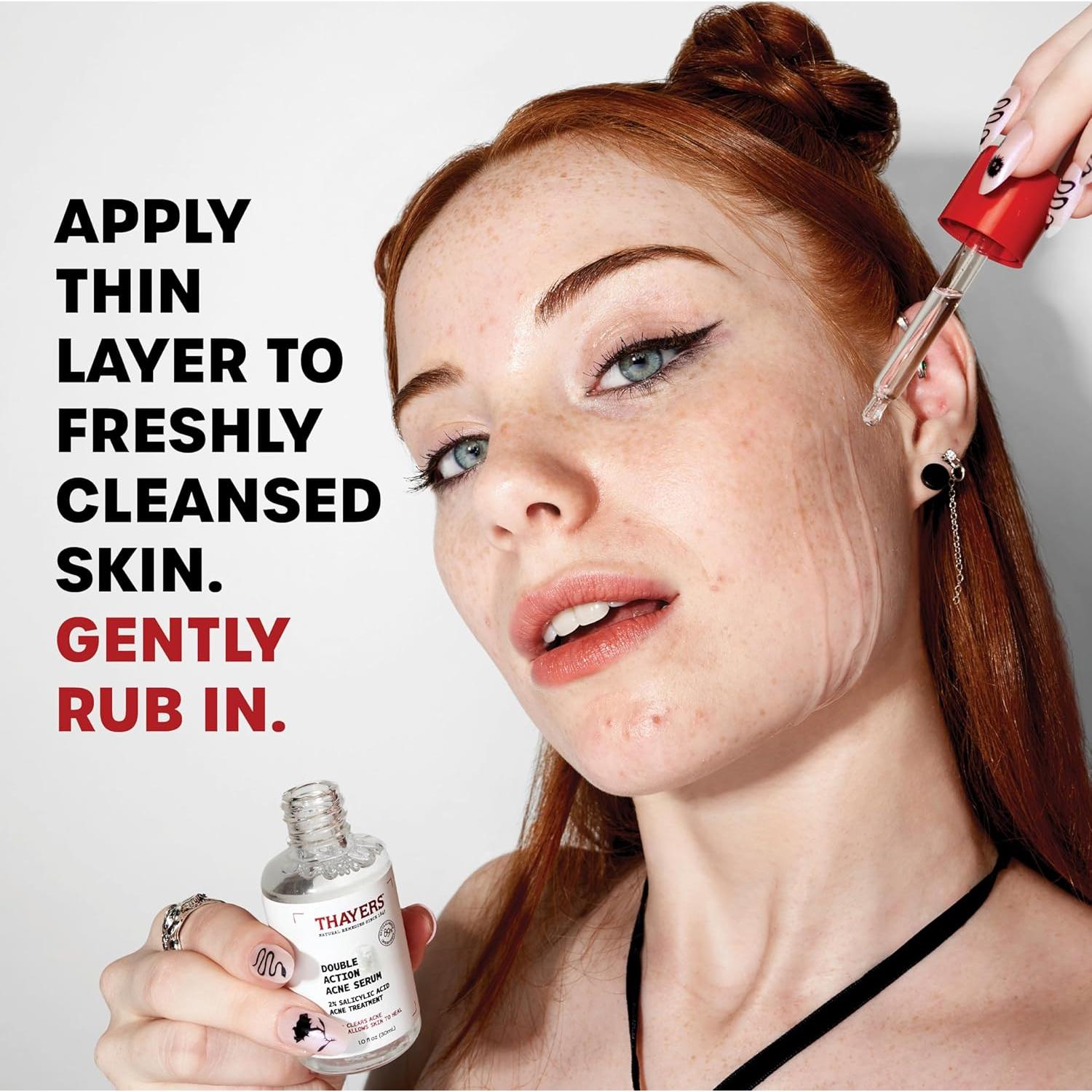 Suero Facial Antiacné Thayers 29.57 ml - 2% Ácido Salicílico