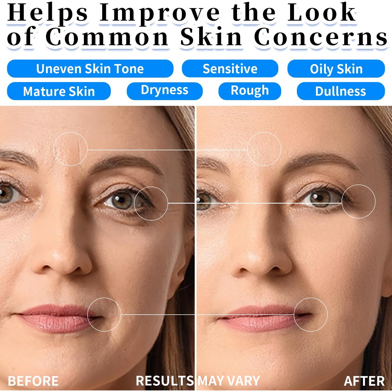 Suero Hidratante Ácido Hialurónico Colágeno 29.57 ml