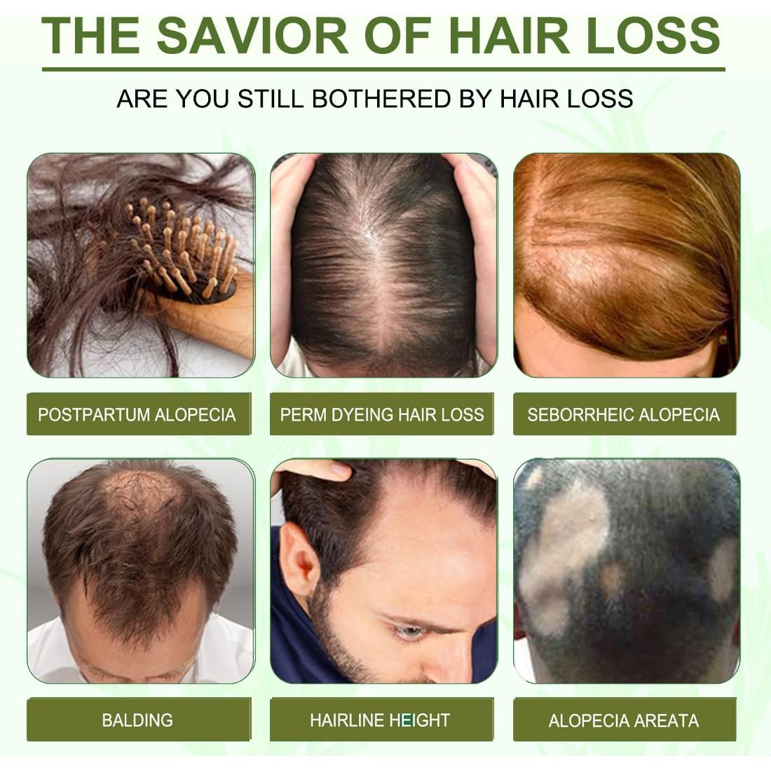 Aceite Natural de Romero y Menta Addabst 100ml - Cuidado Cabello y Piel