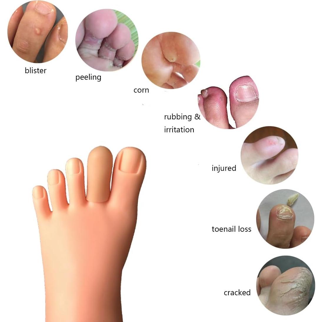 16 Protectores de Dedos Conpru de Goma SEBS para Callos y Ampollas