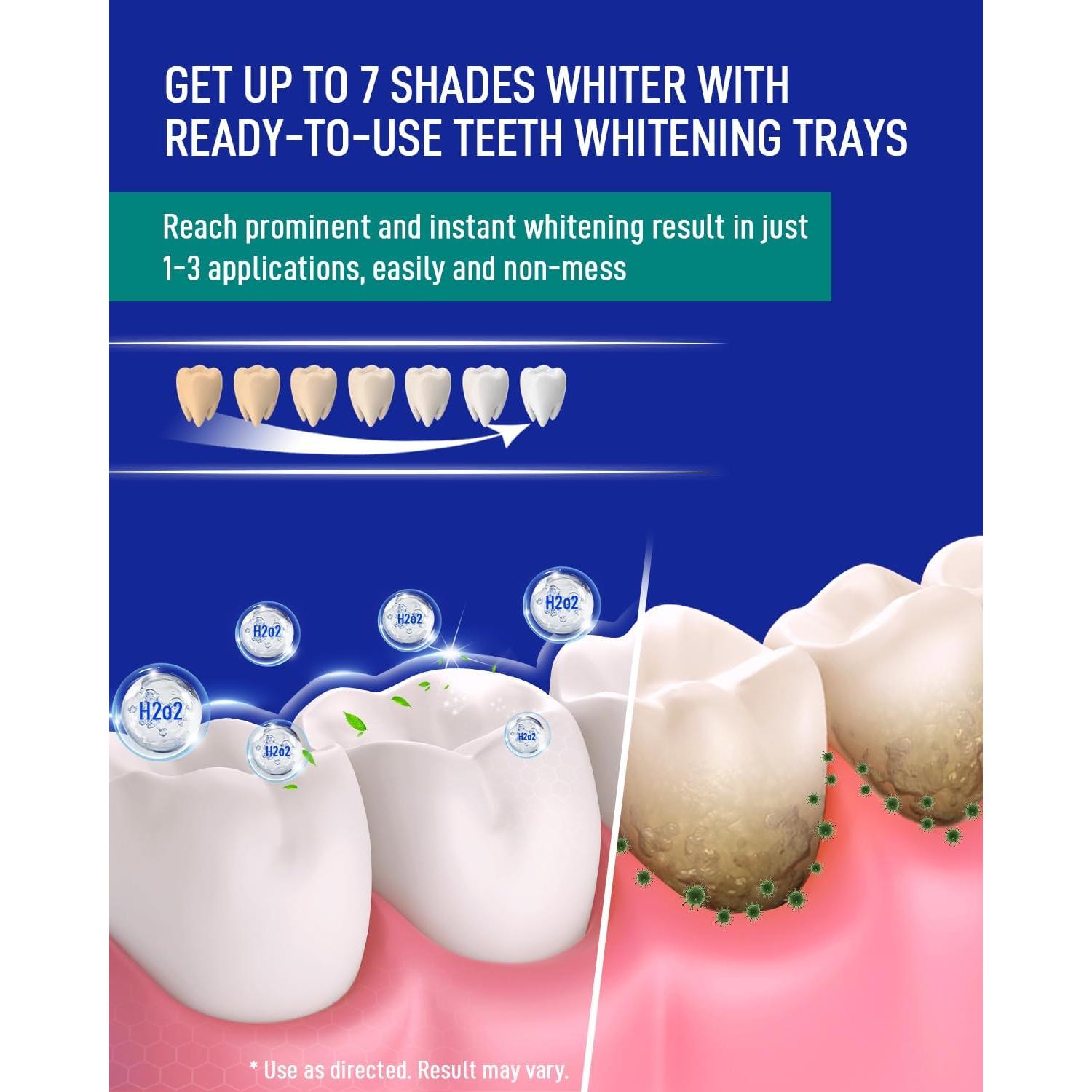 MySmile Kit Blanqueamiento Dental 14 Bandejas 12% Peróxido