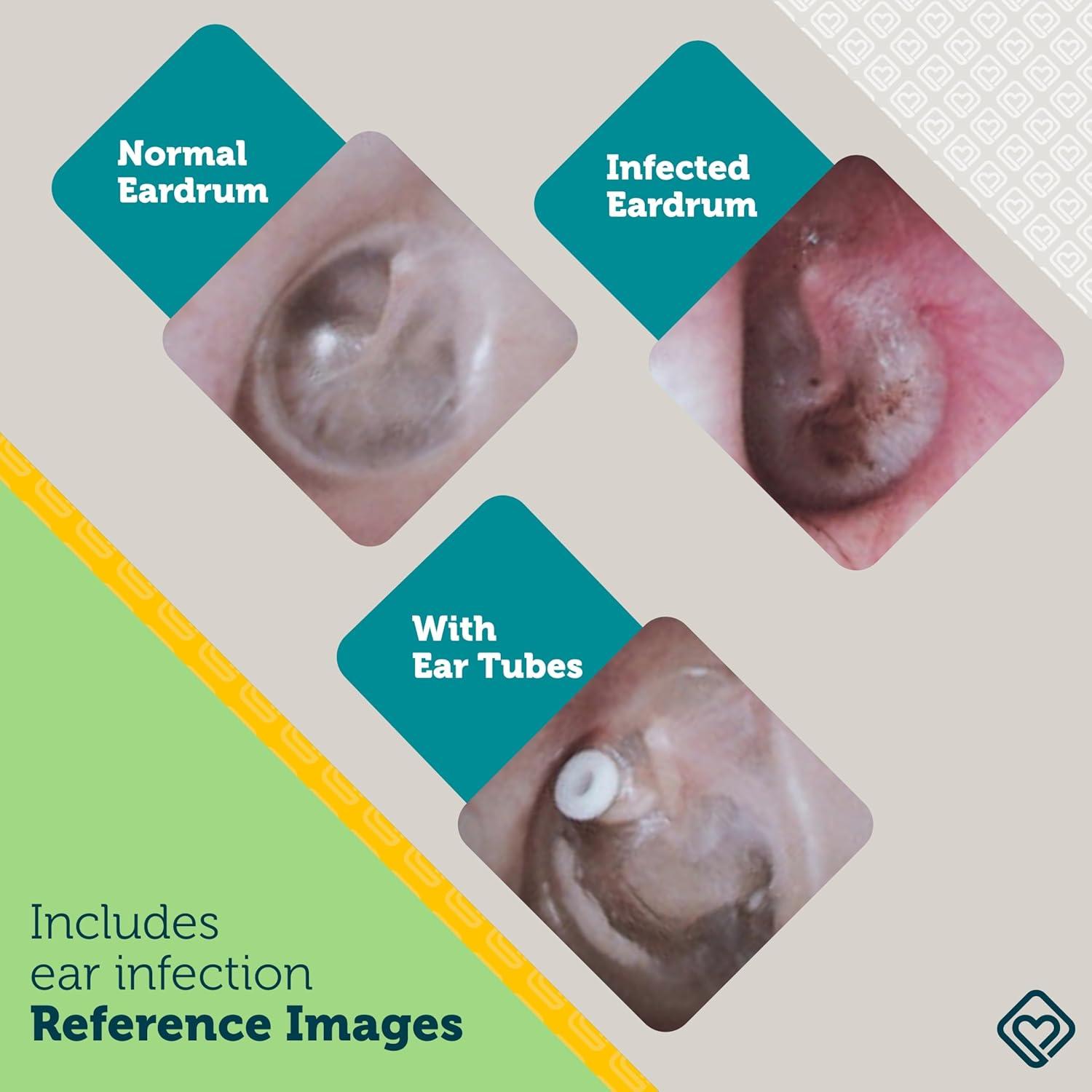 Otoscopio de oído Safety 1st IH481 con luz LED