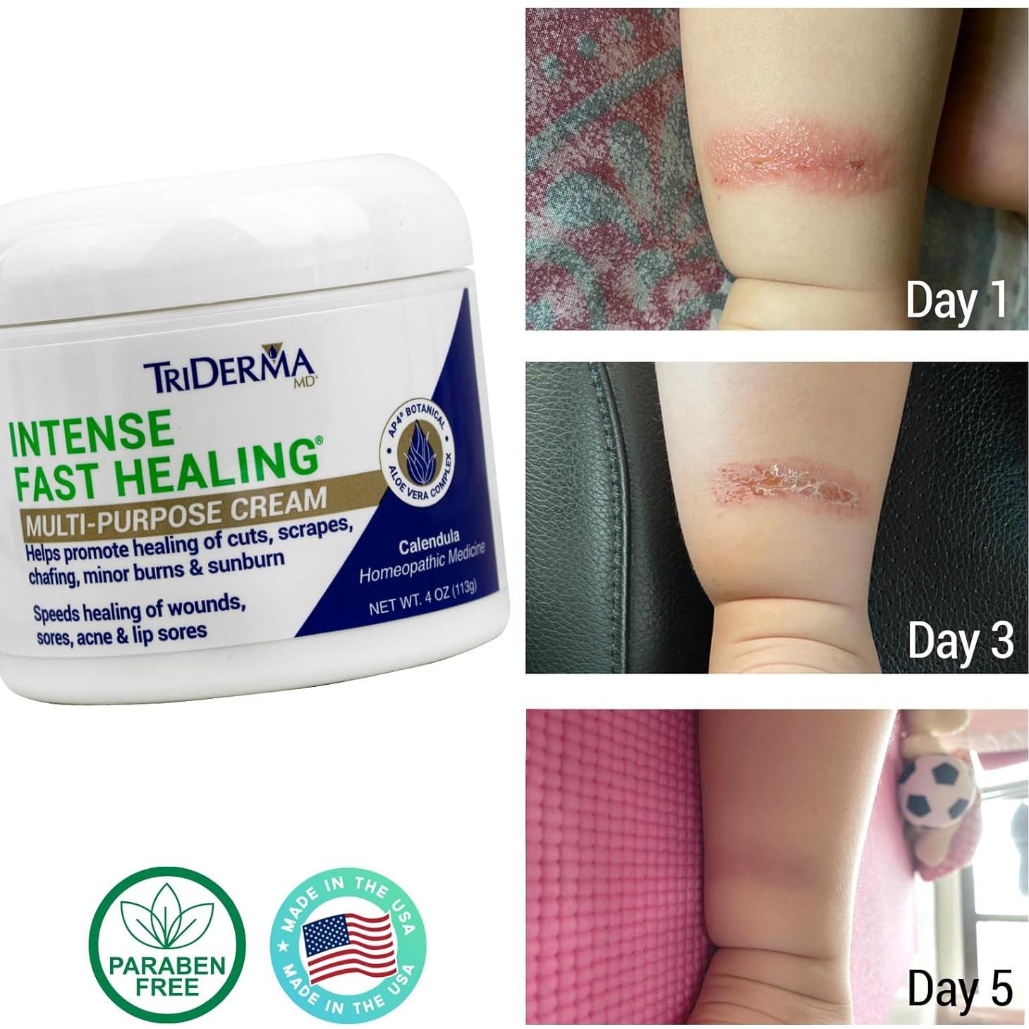 Crema Sanadora TriDerma 113g - Alivio Irritaciones Piel