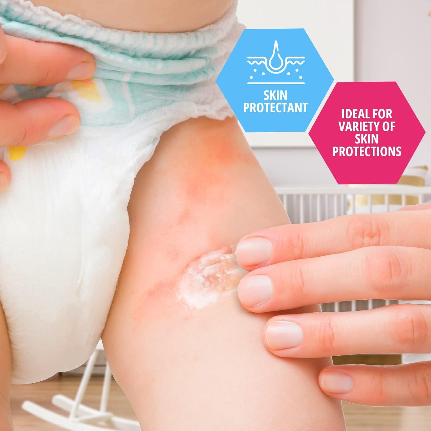 Vaselina de Petróleo Medpride 226.8 g para Bebés - Hidratante