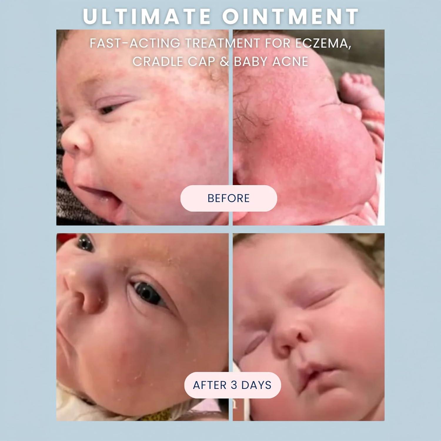 Ungüento para Bebés Noodle & Boo 96g - Protector Piel Eczema