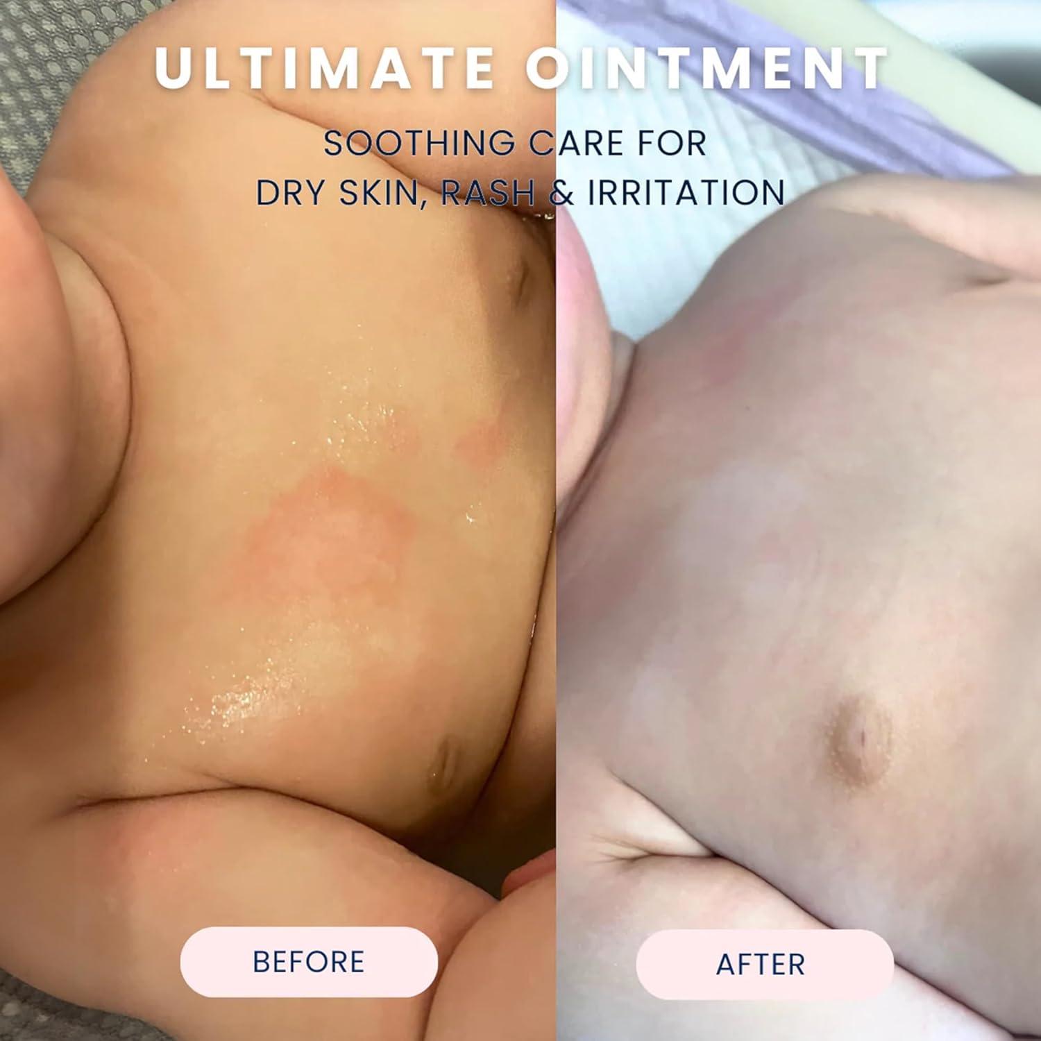 Ungüento para Bebés Noodle & Boo 96g - Protector Piel Eczema