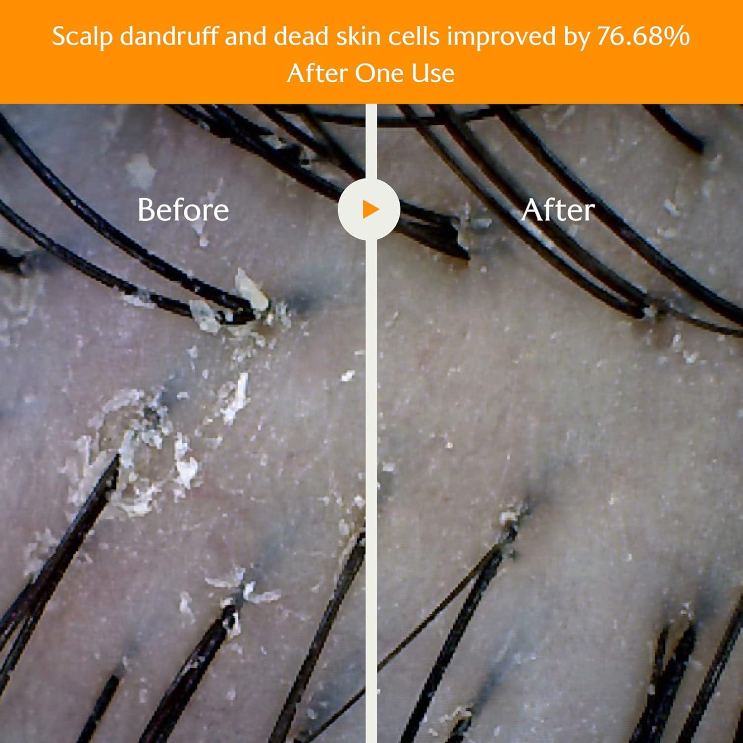 Champú Aclarador LADOR 150 ml - Vinagre de Manzana y Té