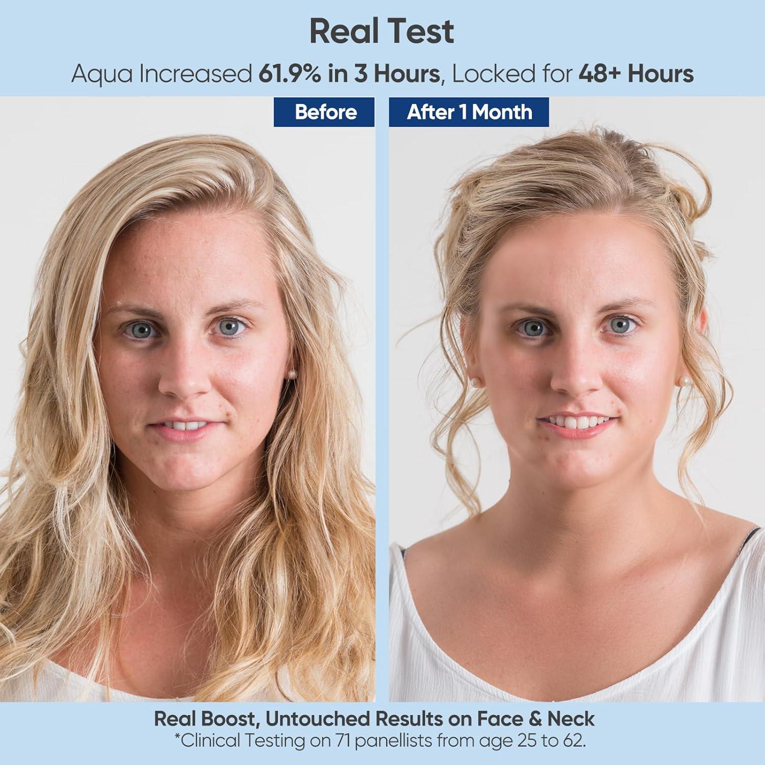 Suero Hidratante Ácido Hialurónico +1HEROLABS 29.57 ml