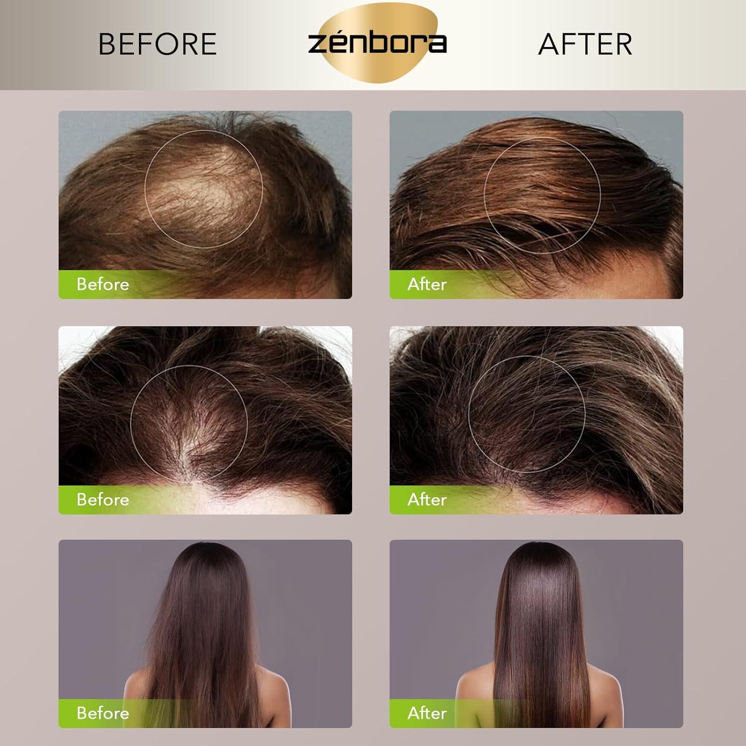 Suero de Vitamina E para Cabello Zenbora - 40 Cápsulas Hidratantes