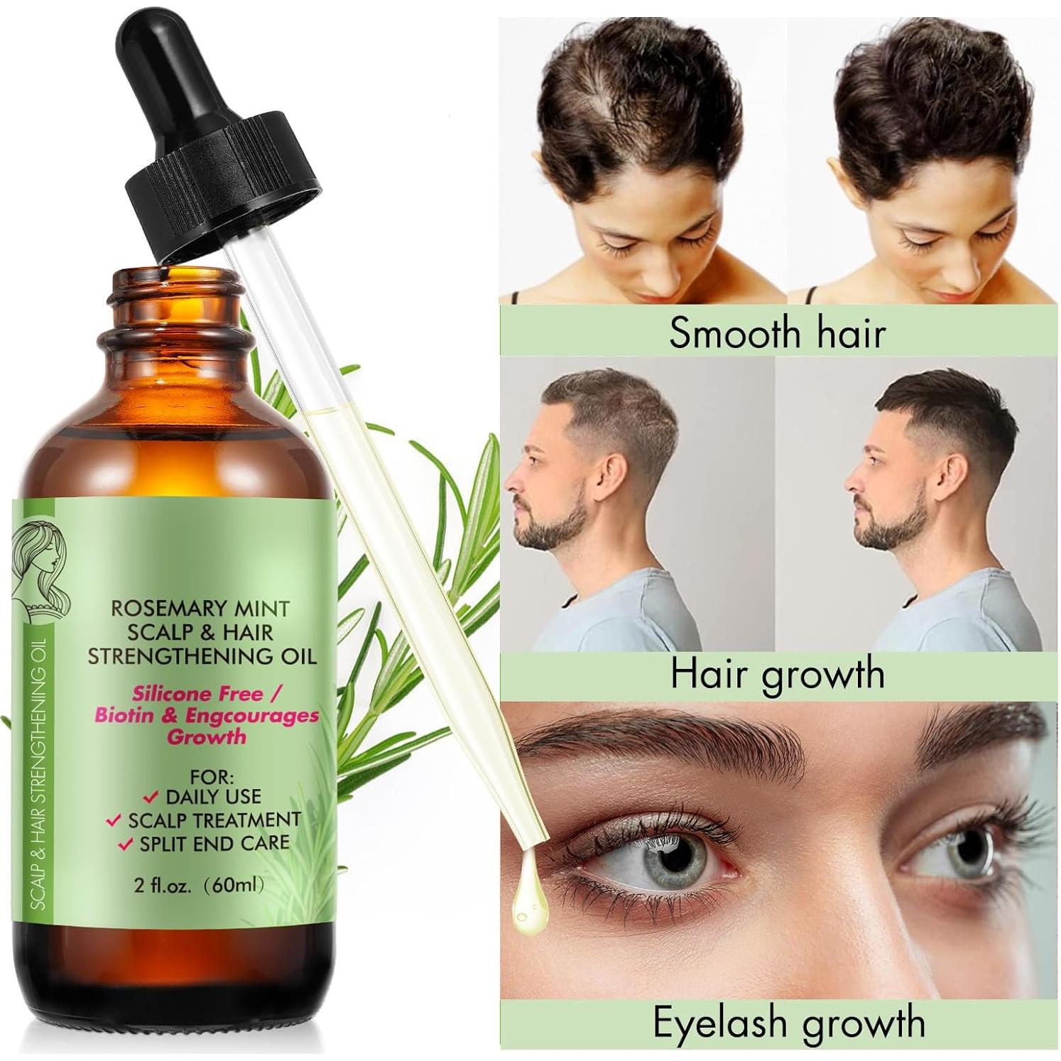 Aceite Esencial de Romero 100% Puro 59.87 ml - Cuidado Cabello