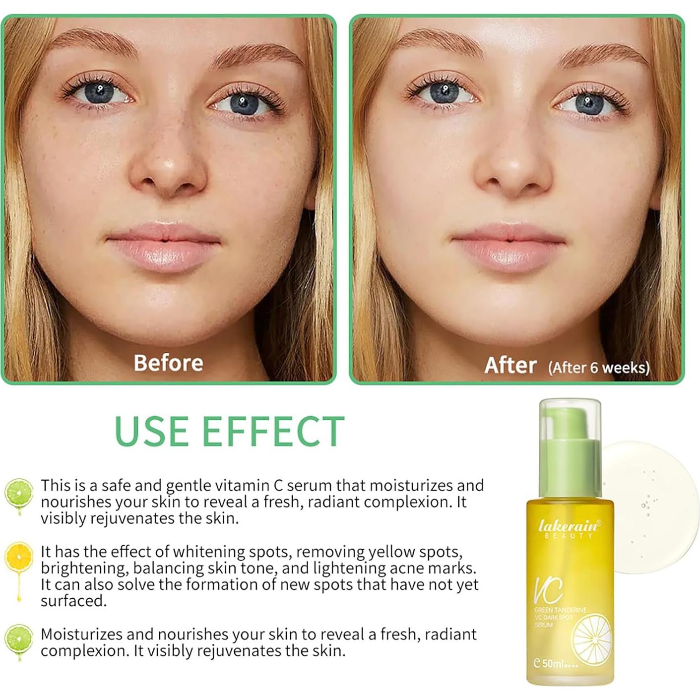 Sérum Facial de Vitamina C Mandarina Verde NICEFACE 50ml