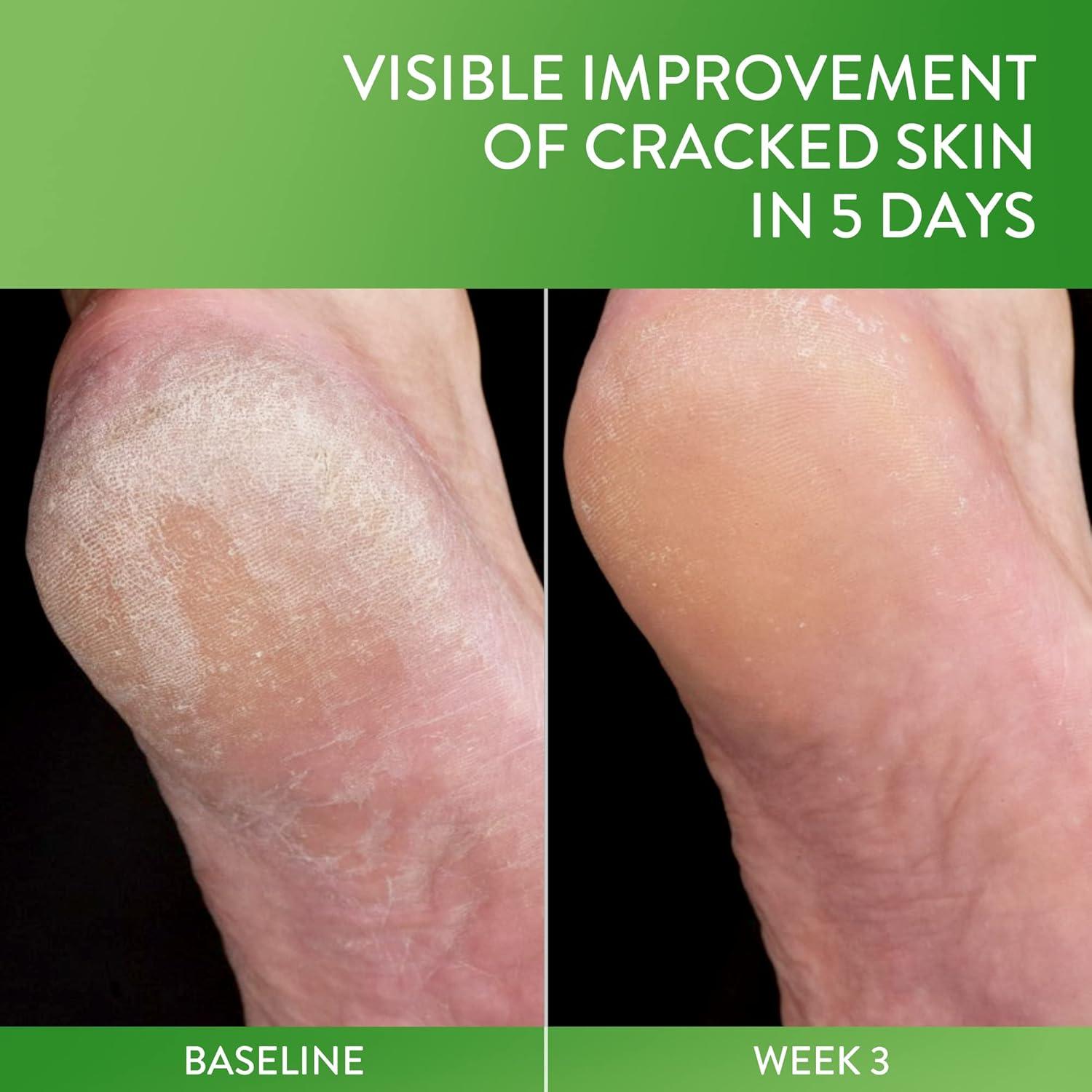 Bálsamo Reparador de Piel Agrietada Cetaphil 85 g Hipoalergénico