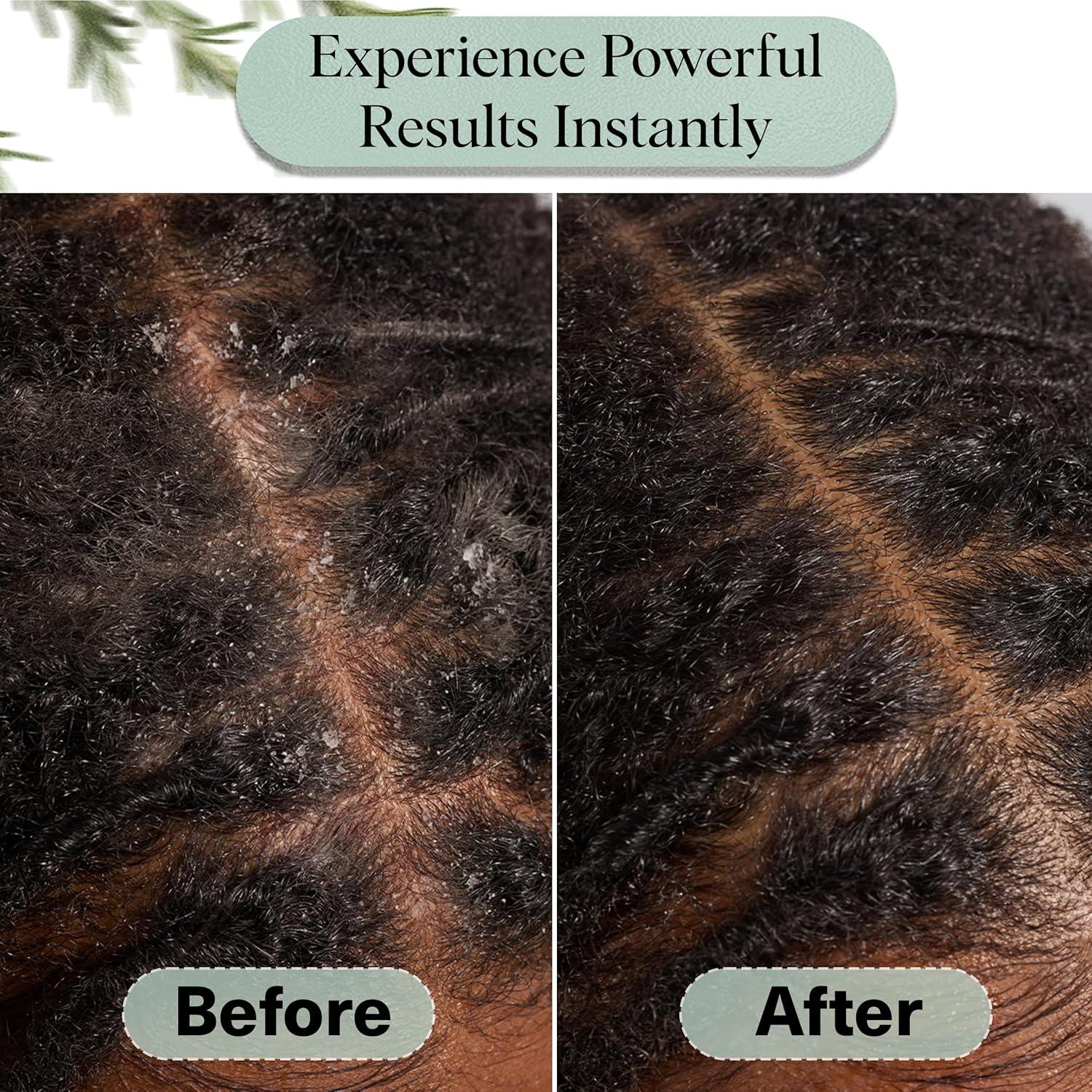 Aceite de Romero Kitsch 10mL para Crecimiento Cabello con Biotina