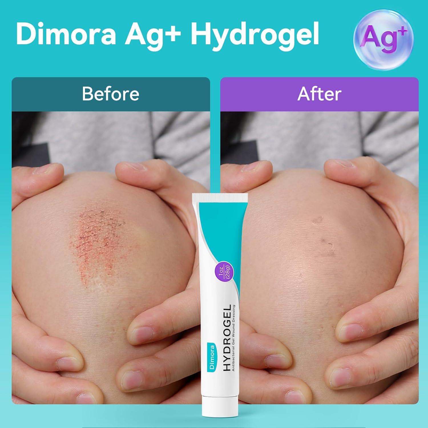 Gel Antibacteriano Dimora Hidrogel Plata 28.35g para Heridas