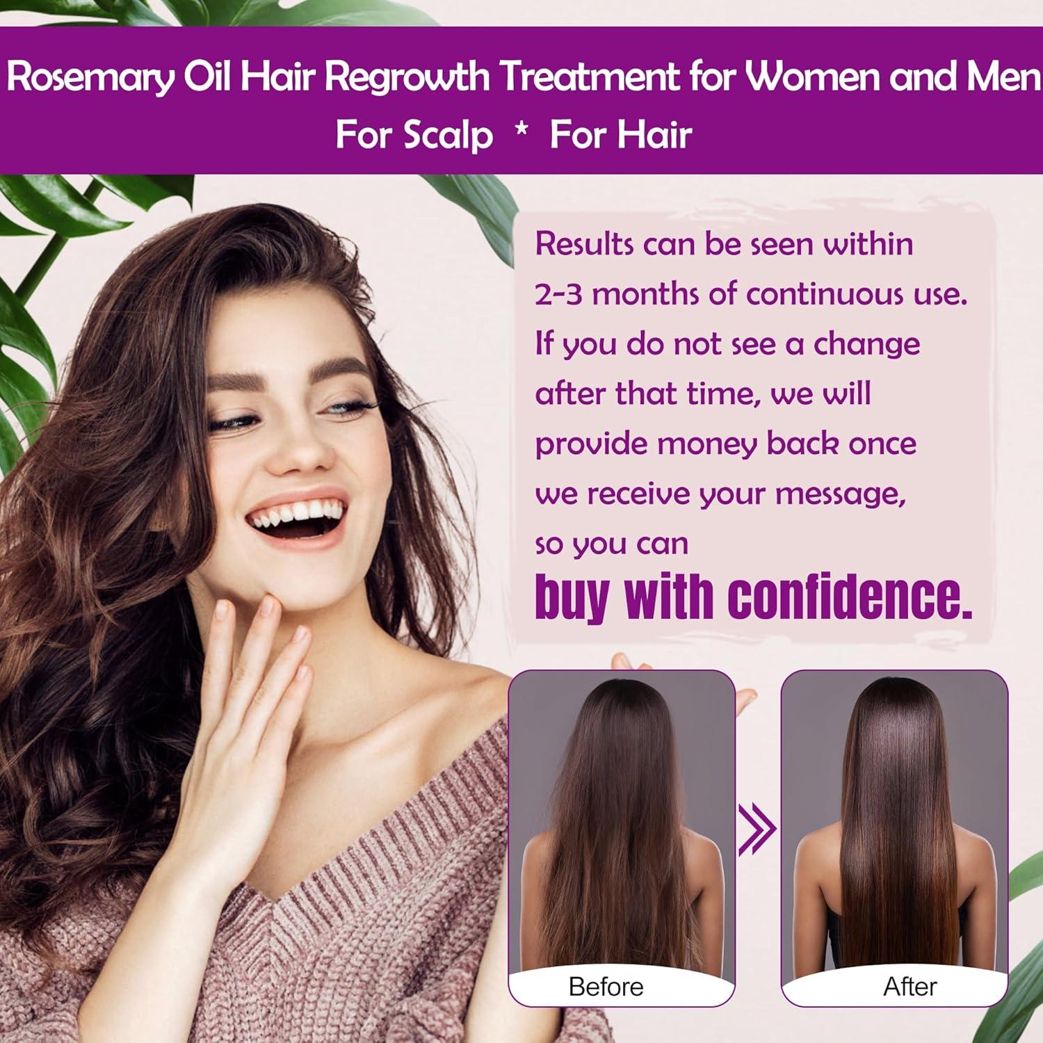 Suero de Crecimiento Capilar GIFBEA con Aceite de Romero y Spray