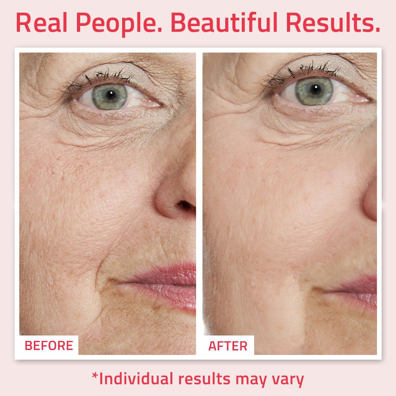 Suero de Retinol YEOUTH 29.57ml con Ácido Hialurónico y Vitamina E