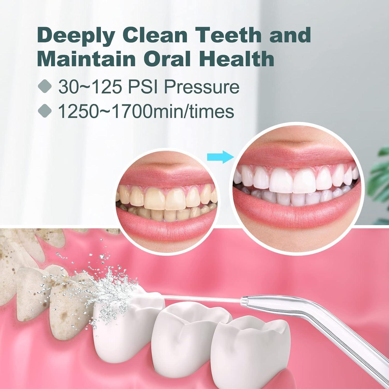 Irrigador Oral Eléctrico Homuserr 600ml con 10 Presiones y 8 Puntas