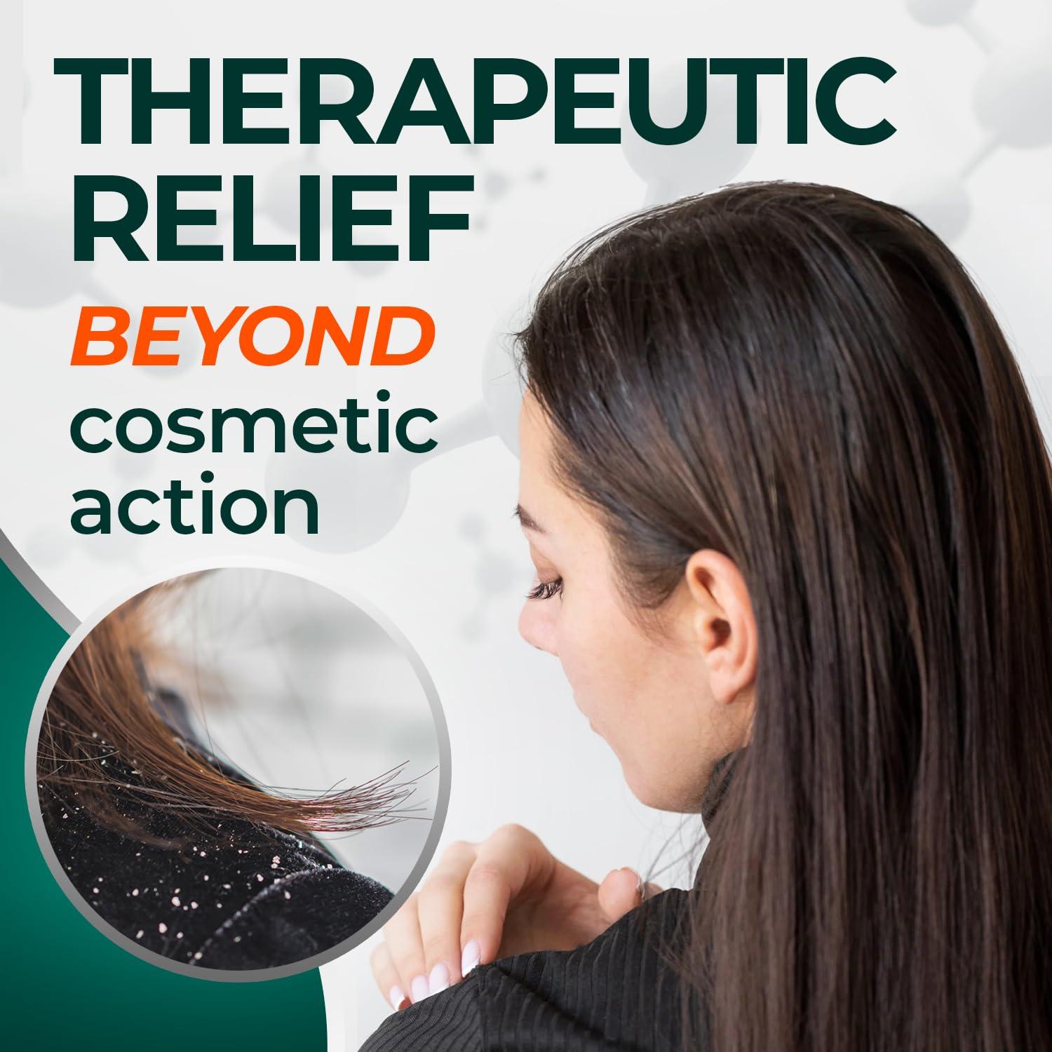 Champú Anticaspa Medicasp 177 ml con Alquitrán de Hulla