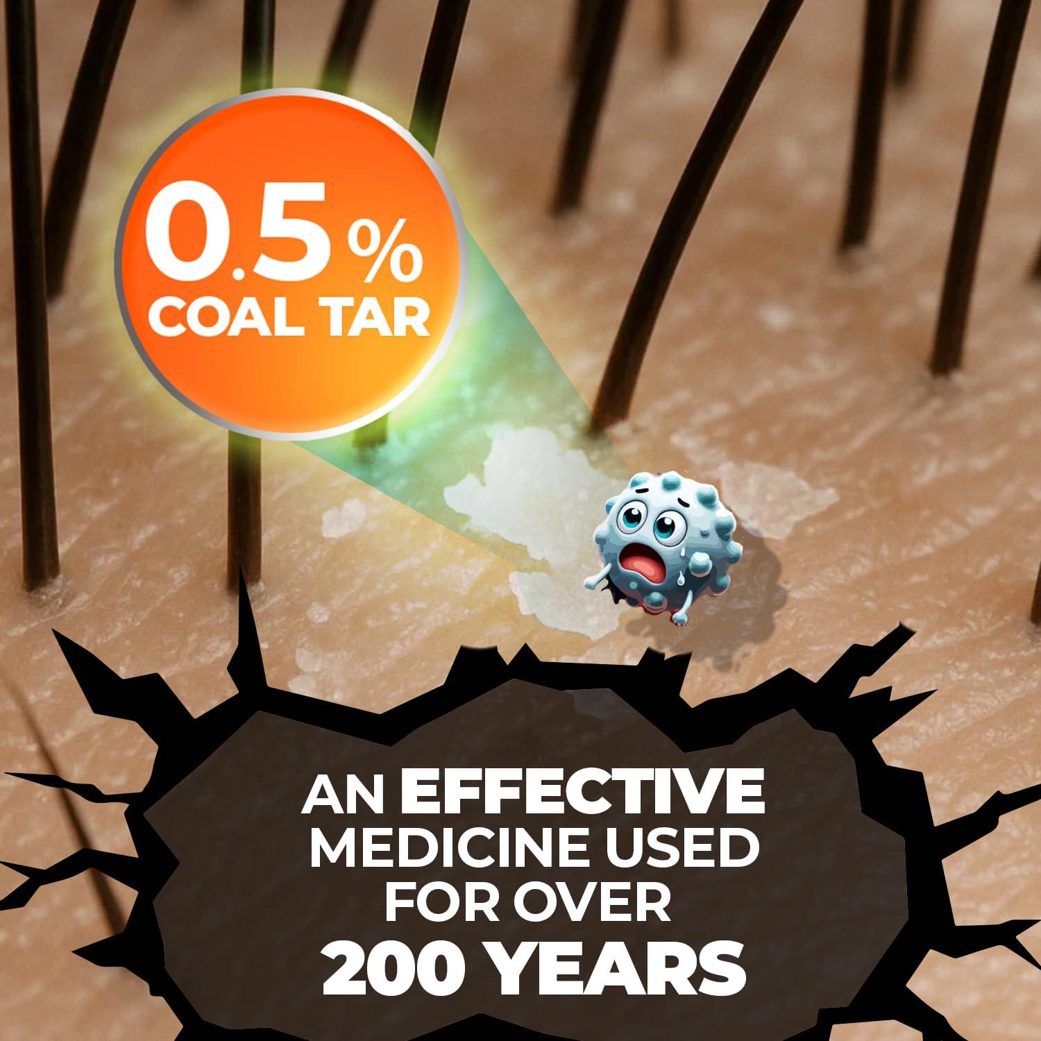 Champú Anticaspa Medicasp 177 ml con Alquitrán de Hulla