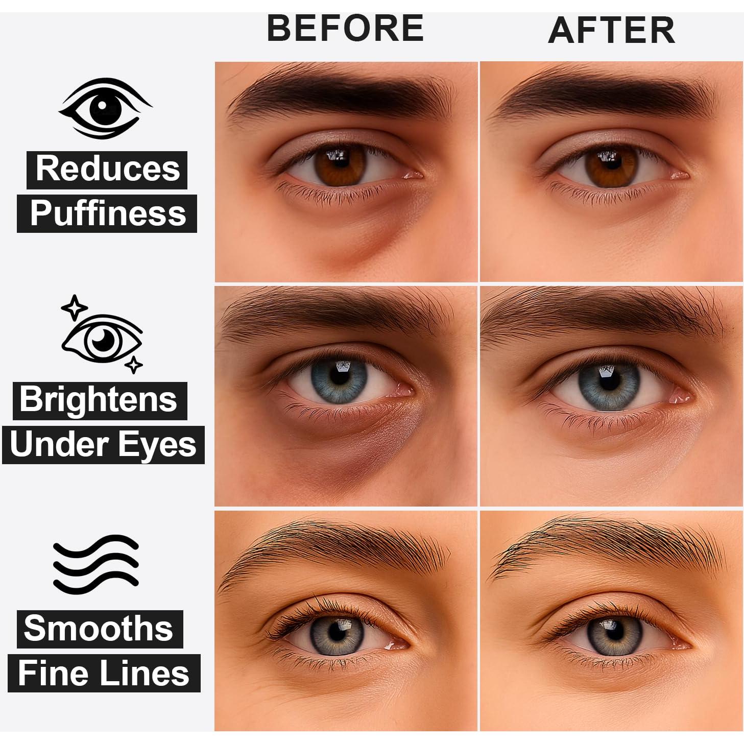 Parche Hidrogel para Ojos TINTARK 28 Pares con Cafeína y Trufa