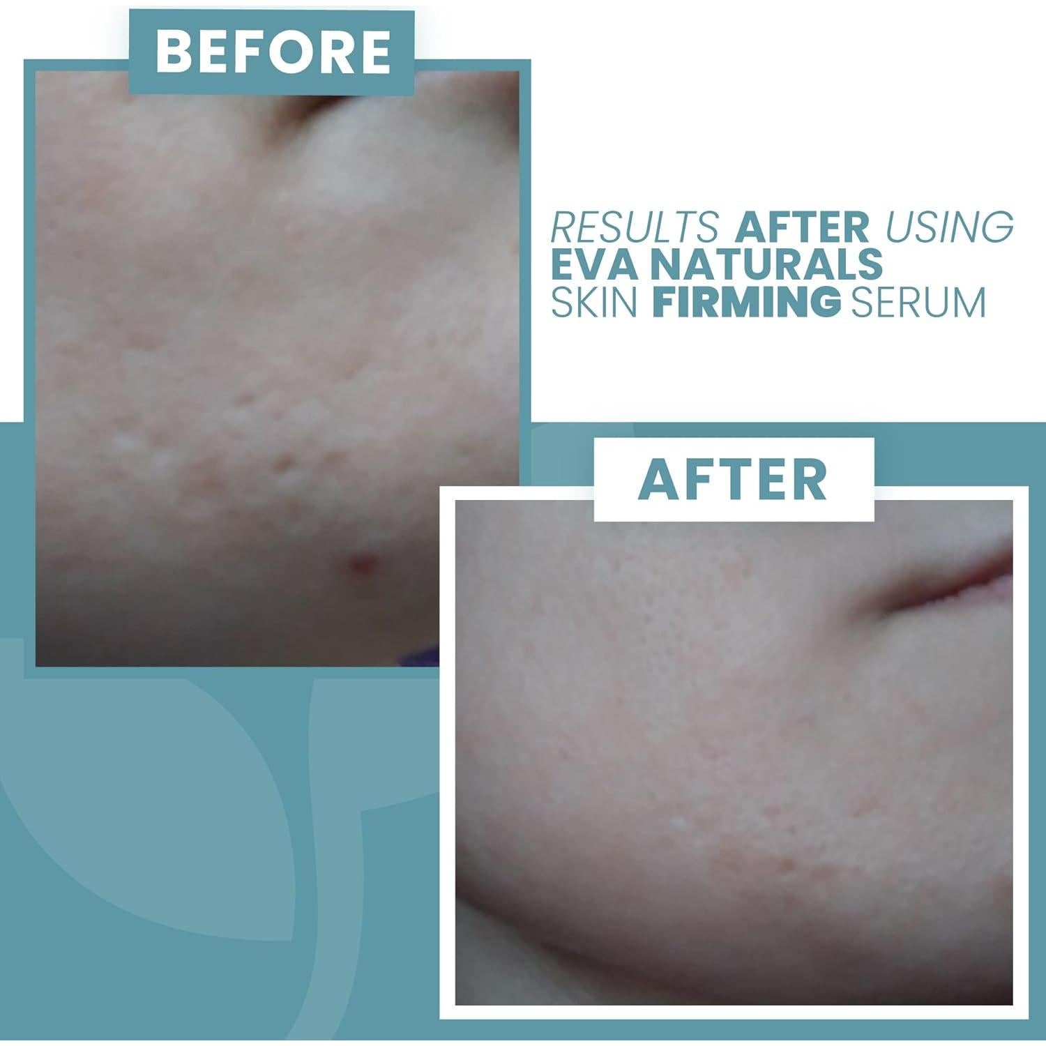 Suero Reafirmante Facial Eva Naturals 29.57 ml Niacinamida